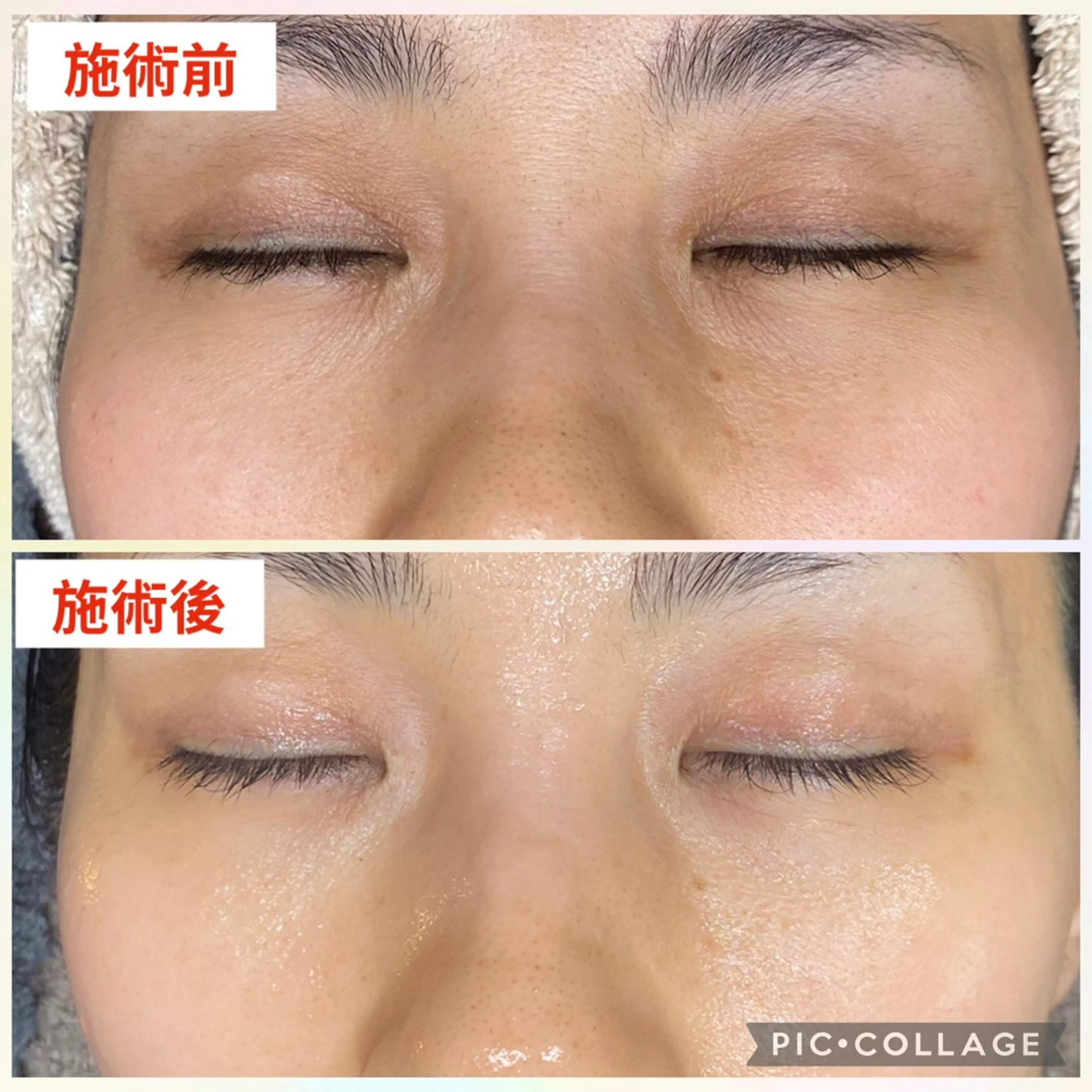 エステ 肌質改善サロン with Uのエステ・リラクイメージ