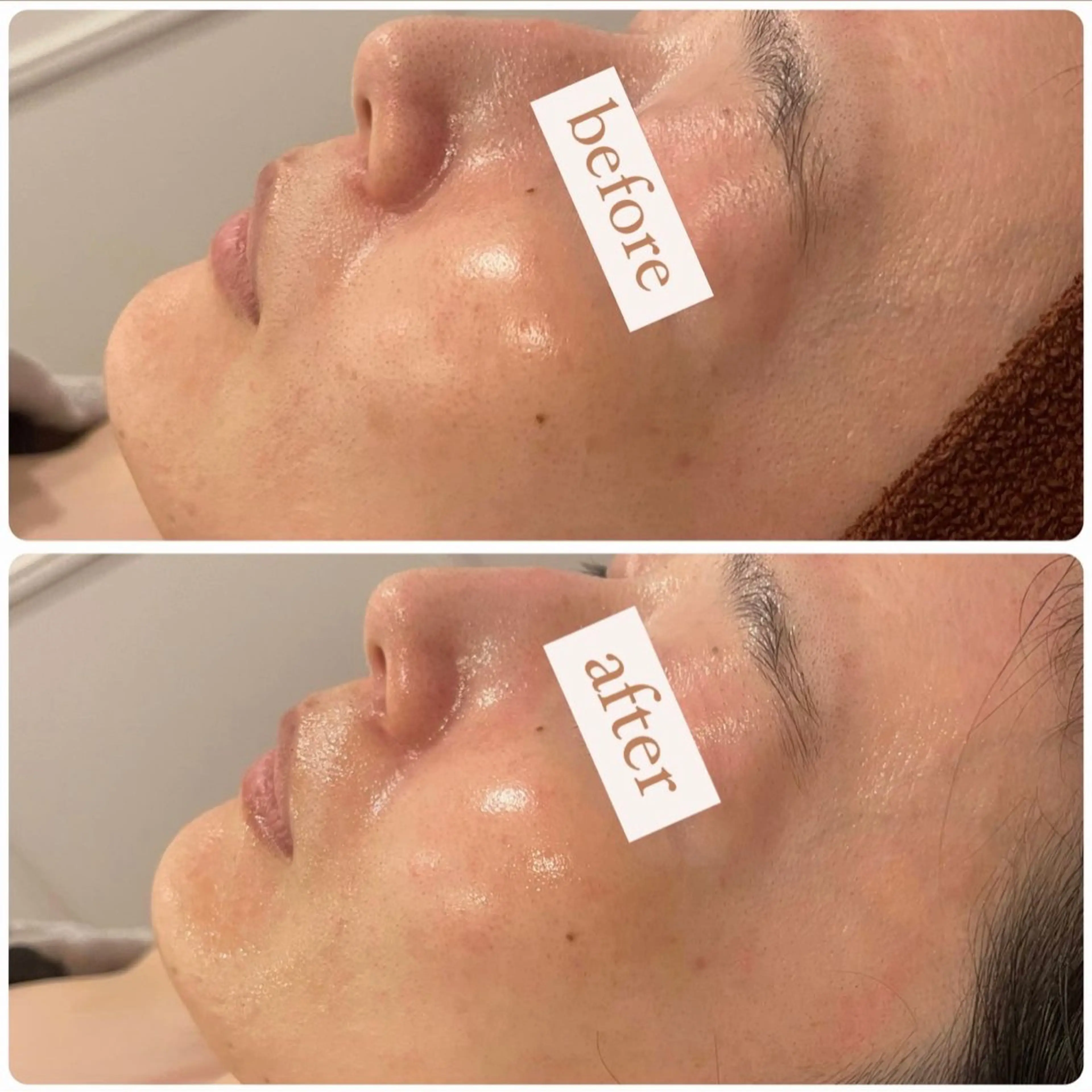 立体小顔×艶肌×美ボ ディ似合わせ施術 岡のエステ・リラクイメージ