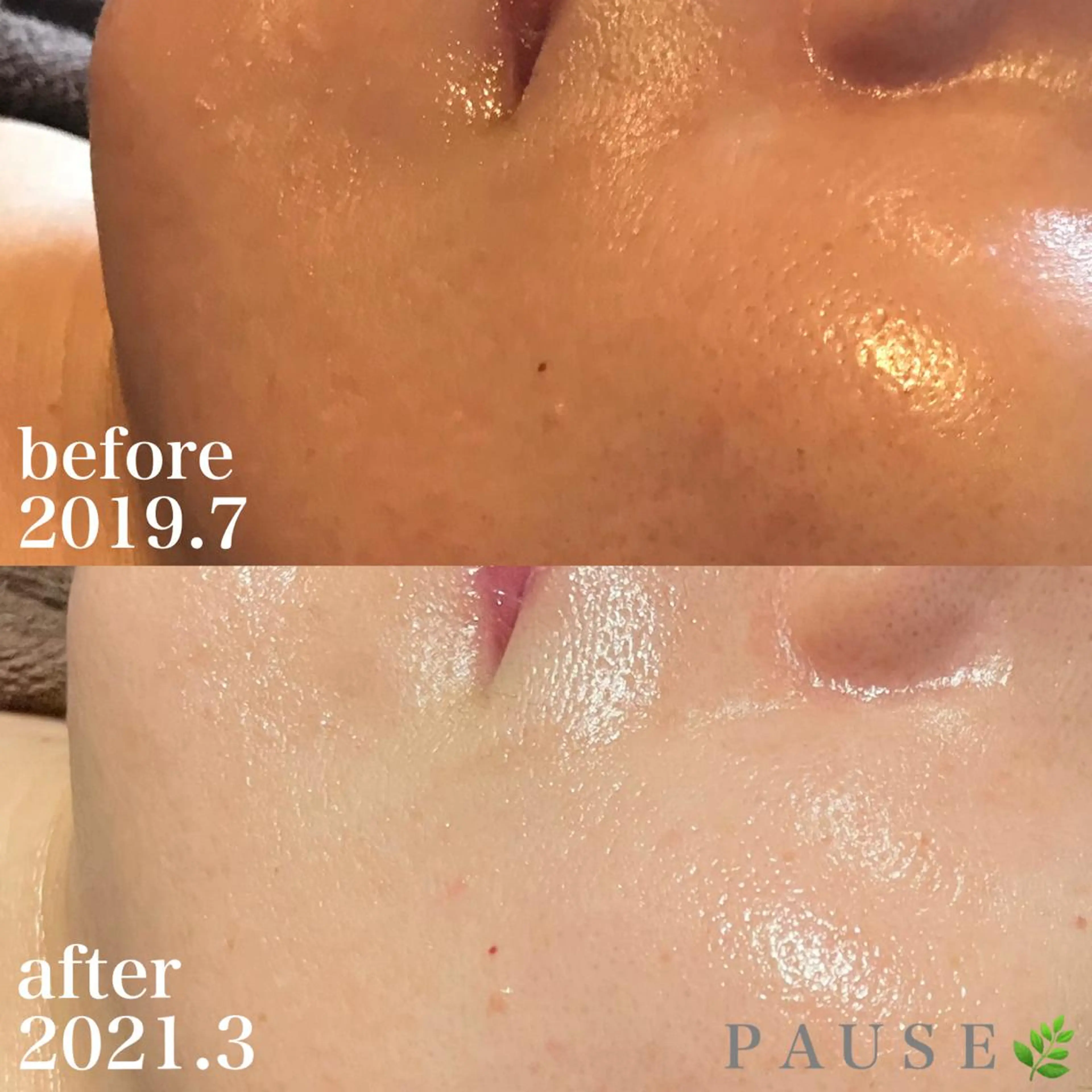 エステ 浜野 恵美のエステ・リラクイメージ