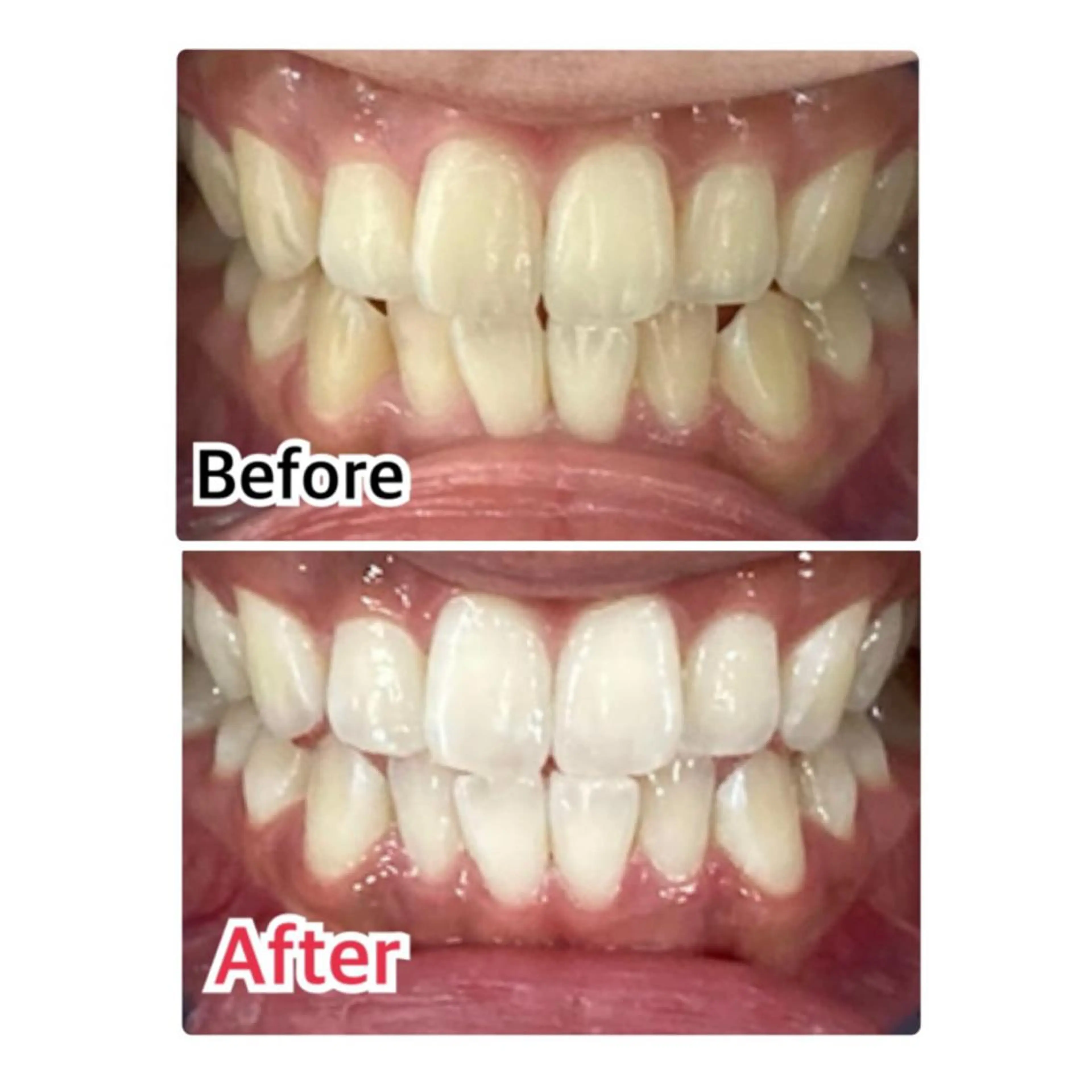 カラー メンズ キッズ マツエク・マツパ プラチナムビューティー柏所属・【歯科提携】柏ホワイ トニングスタイルのその他イメージ