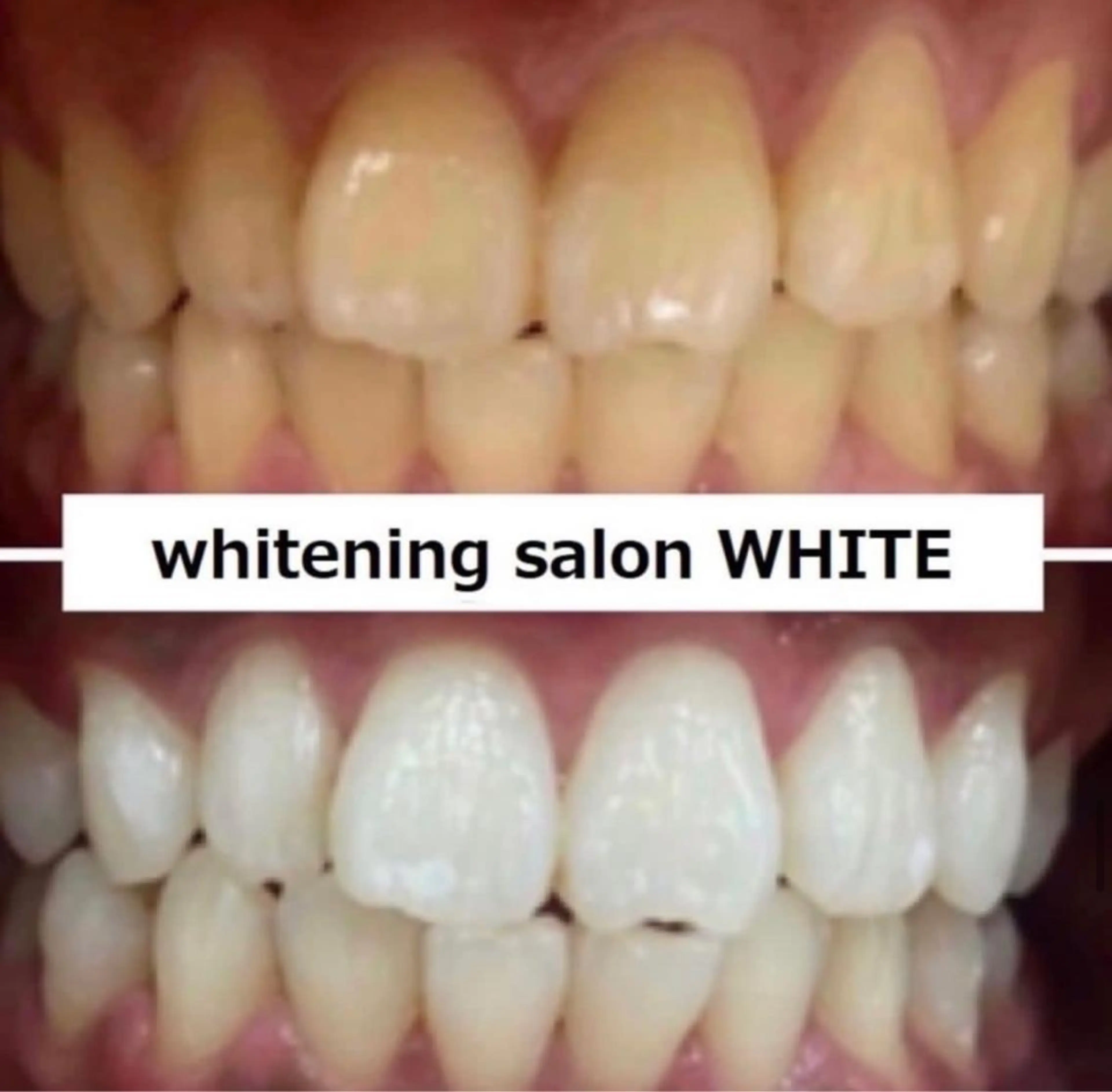 セルフホワイトニング 専門店WHITE広島のその他イメージ