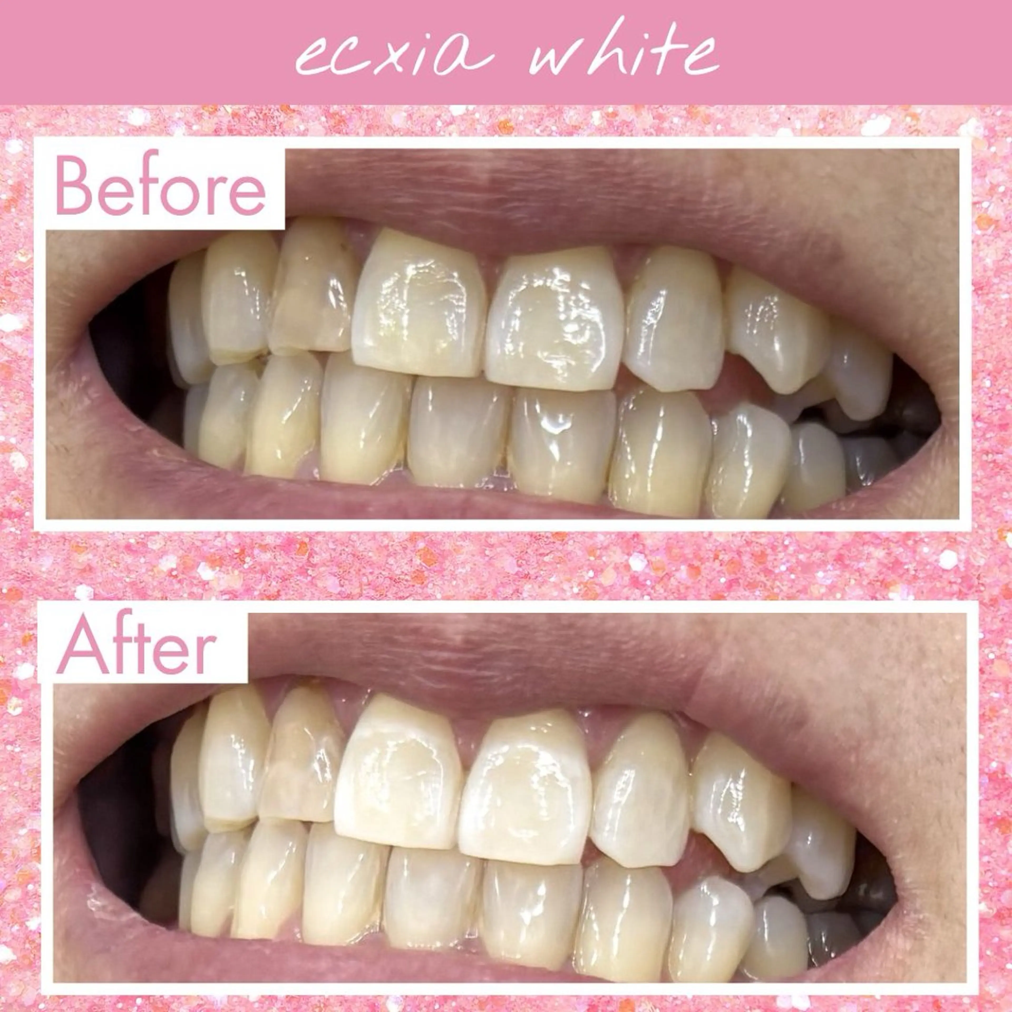 エクシアホワイトニング伊勢店所属・セルフホワイトニング エクシア伊勢店のその他イメージ