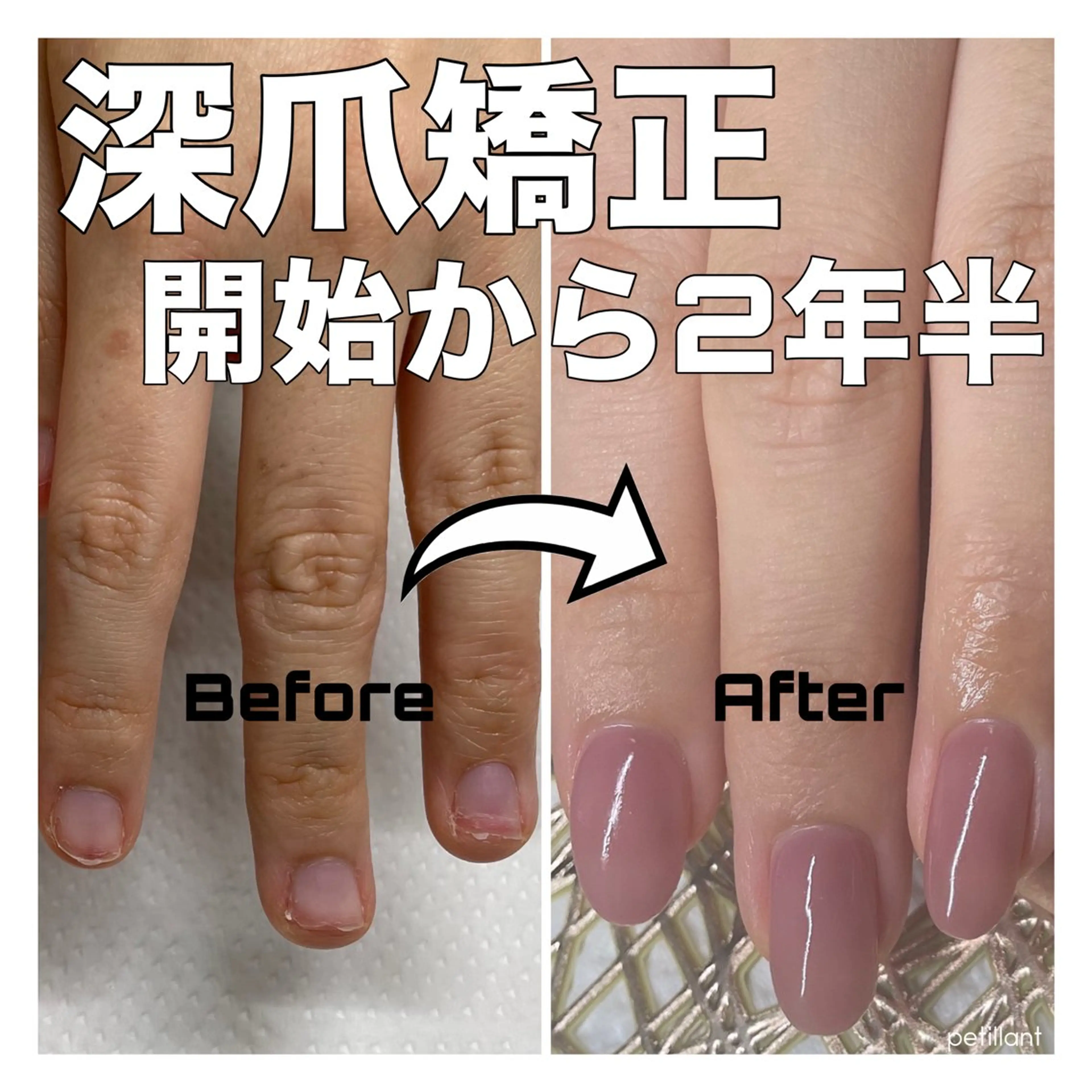 ネイル 卒業式 ピンク nail salon petillantのネイルデザイン