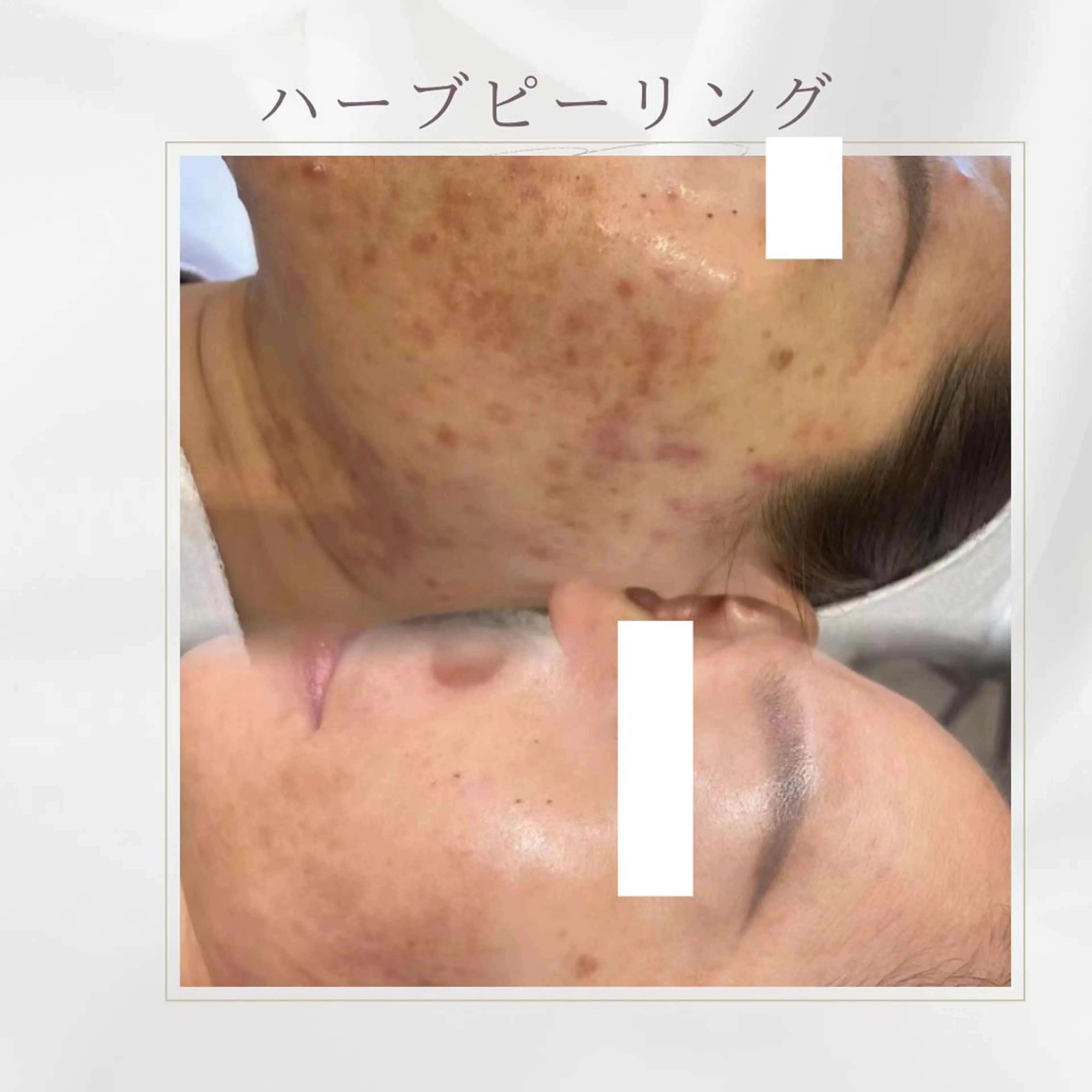 西区九条エステ MITUREIサロンのエステ・リラクイメージ