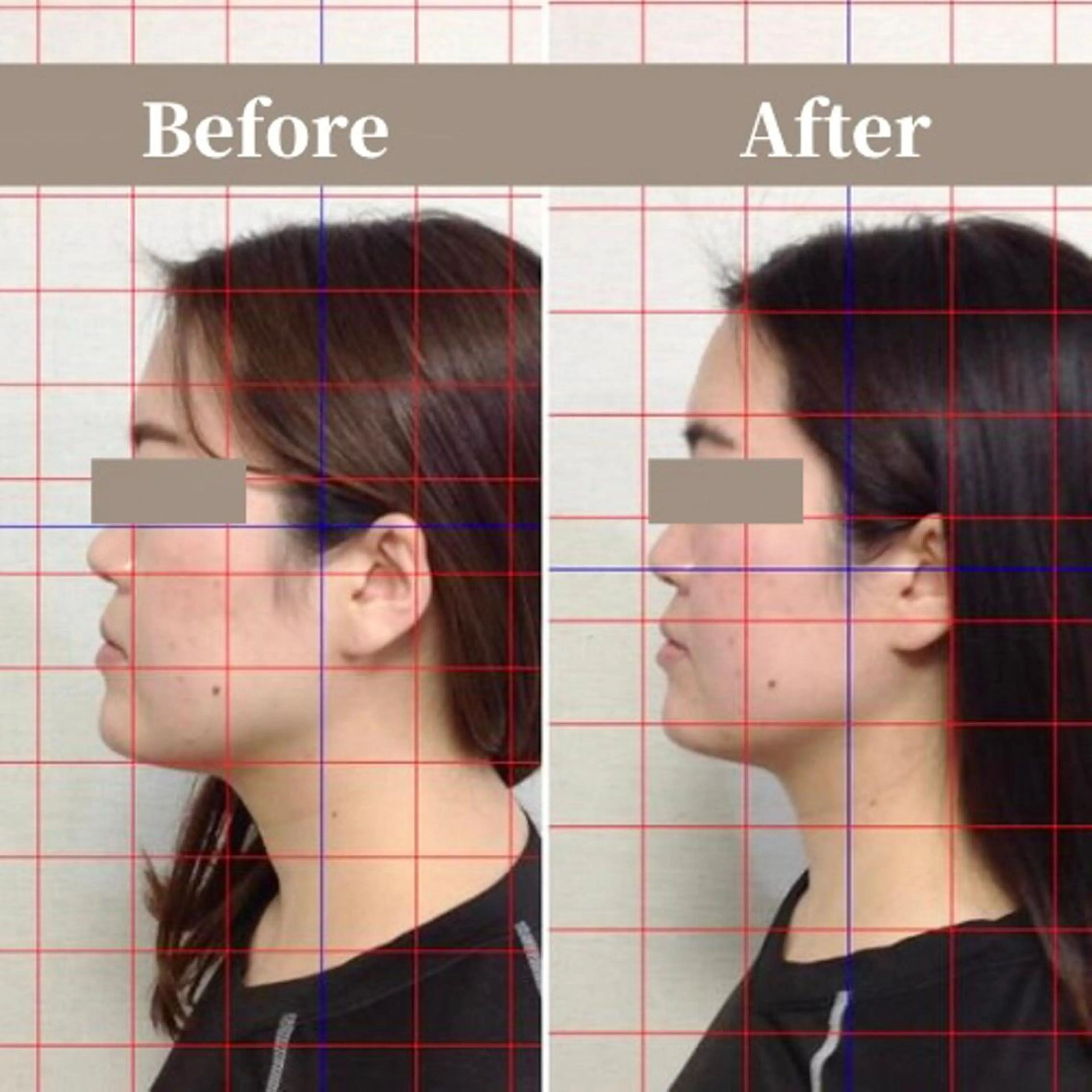 【顔も首肩も気になる方に】小顔矯正＋首肩矯正  60分  12,100円→6,600円の写真