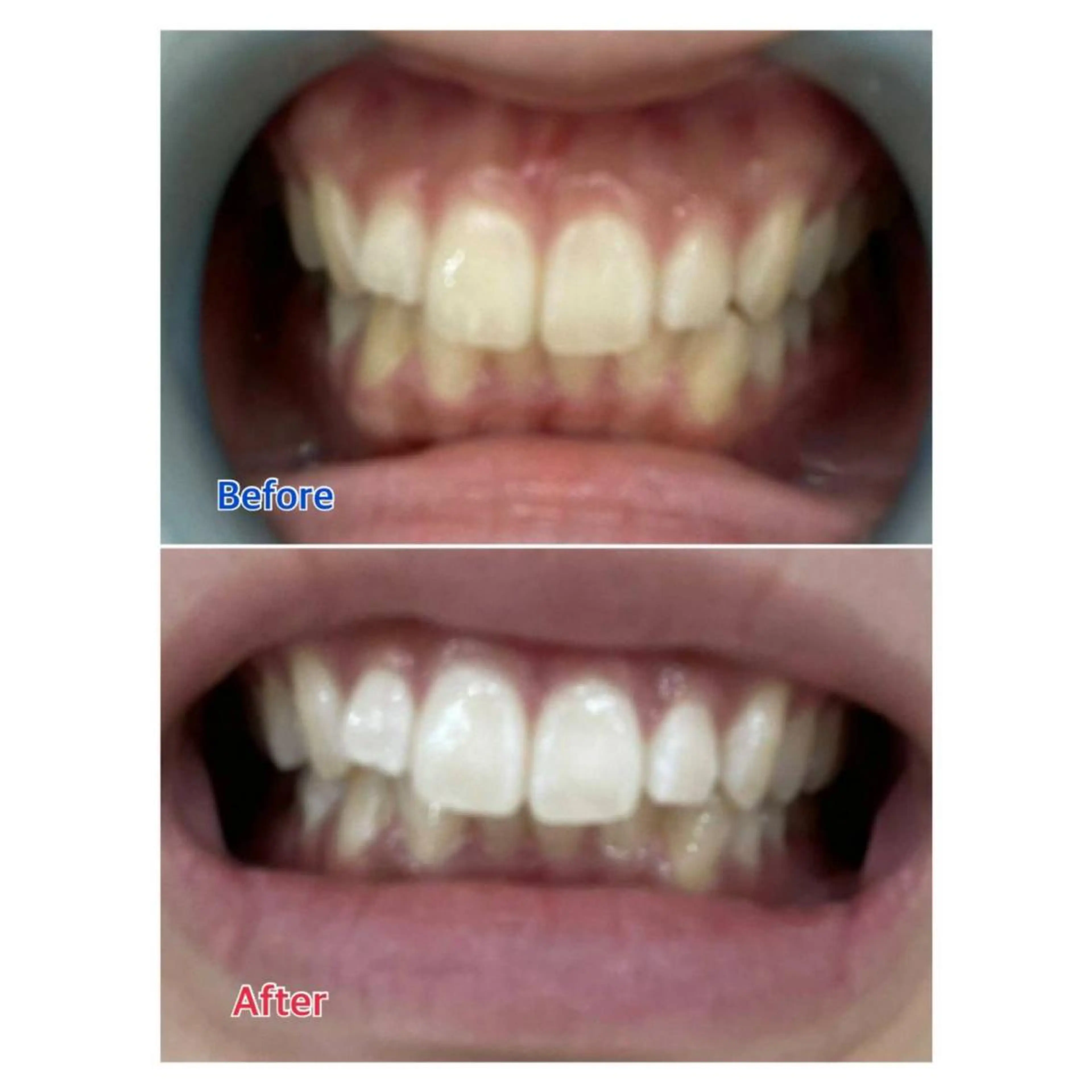 MBEAUTYSALON 千葉店・京成大久保所属・Melty 輝のその他イメージ