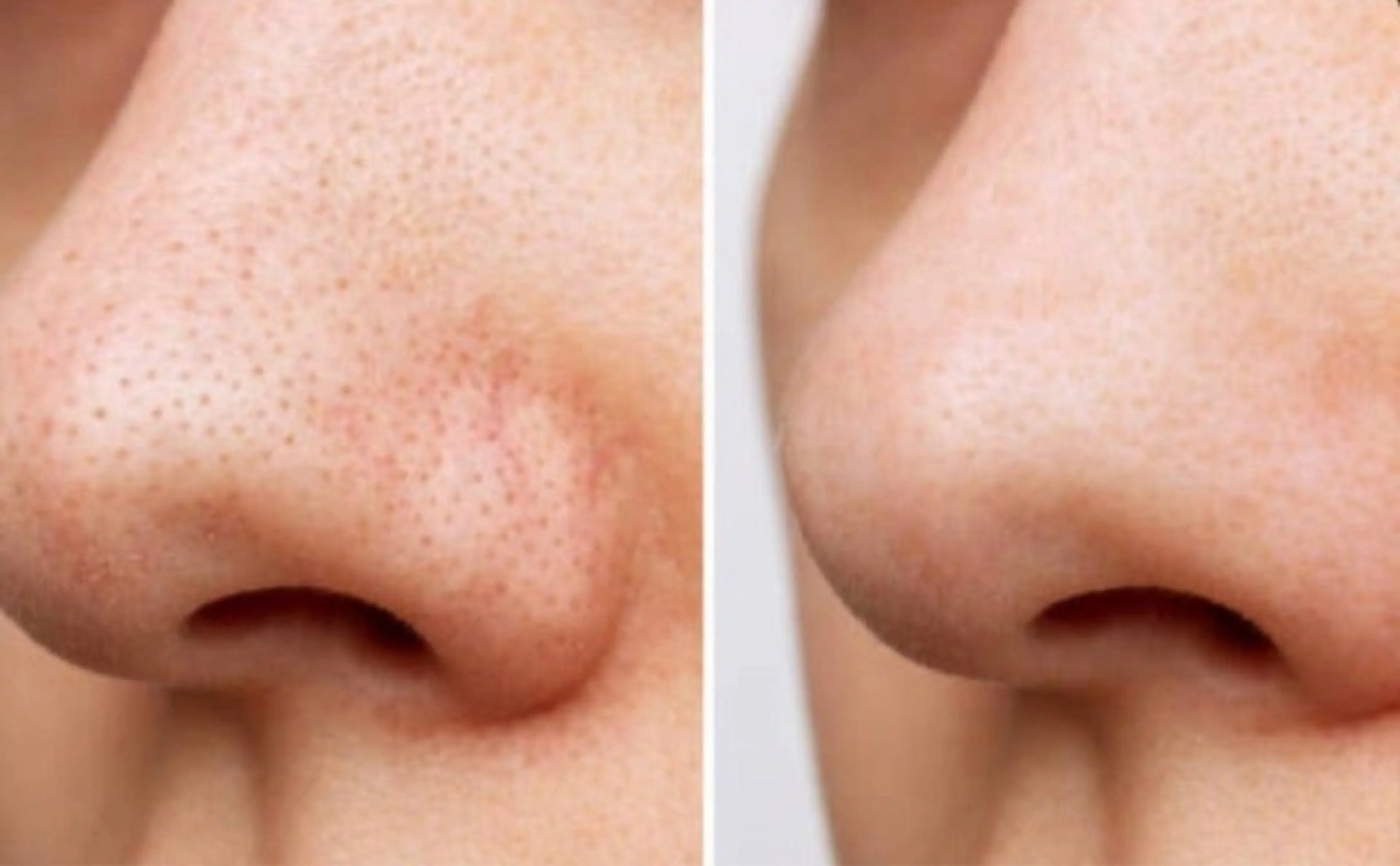 DESIGN FAM エステのエステ・リラクイメージ