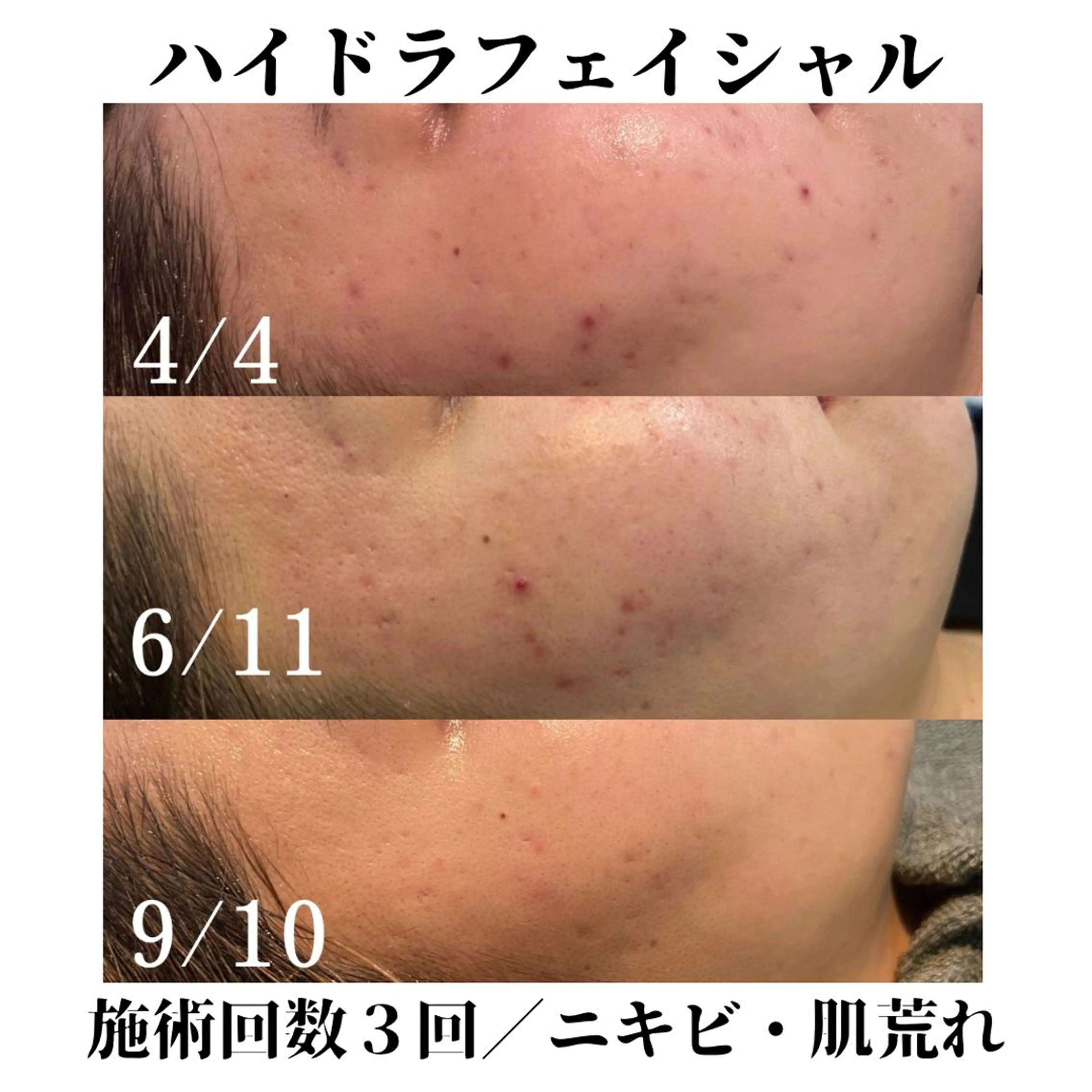 トータルビューティー サロンSalaのマツエク・マツパデザイン