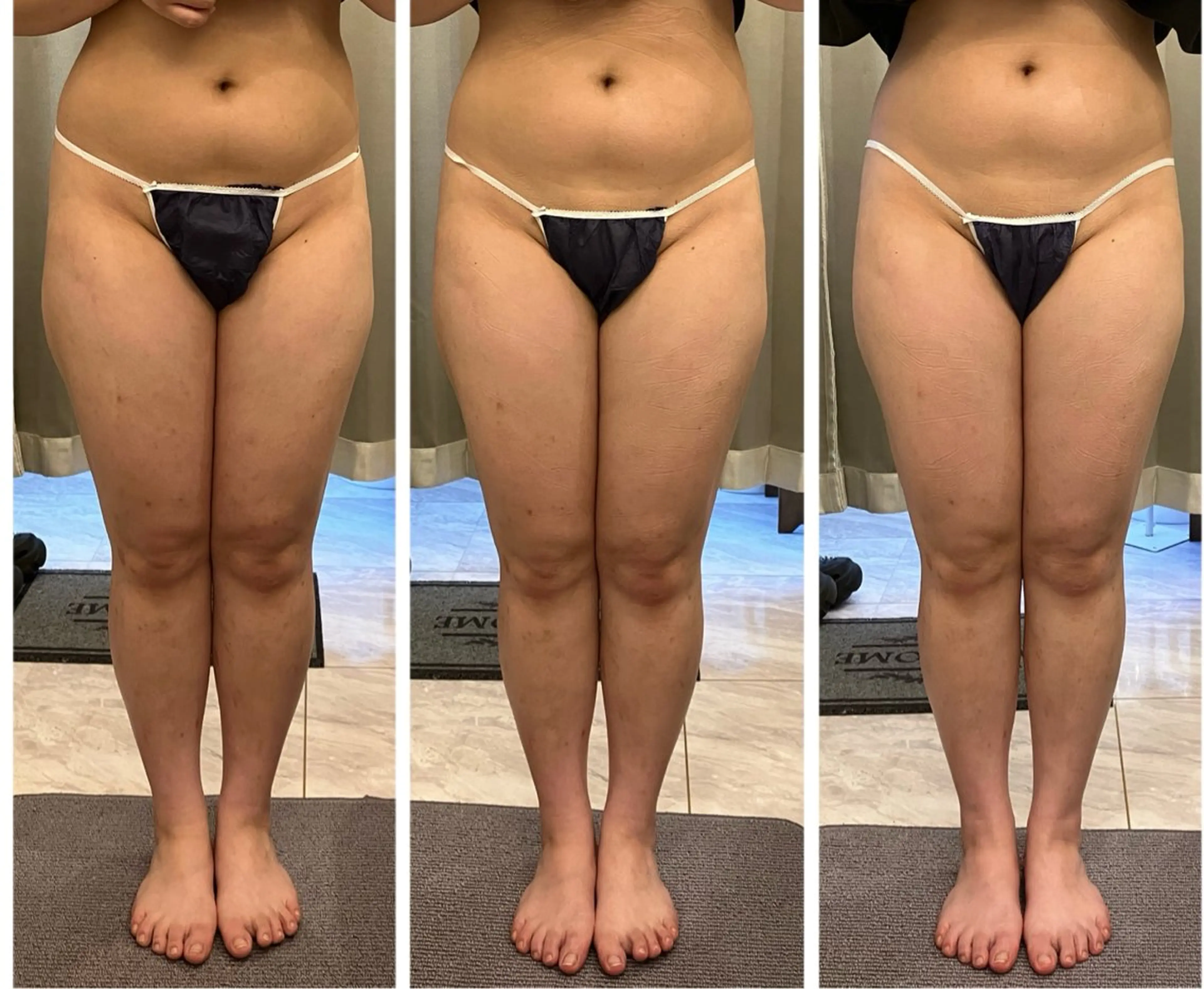 エステ リラク infinity所属・Infinity KAYOのその他イメージ