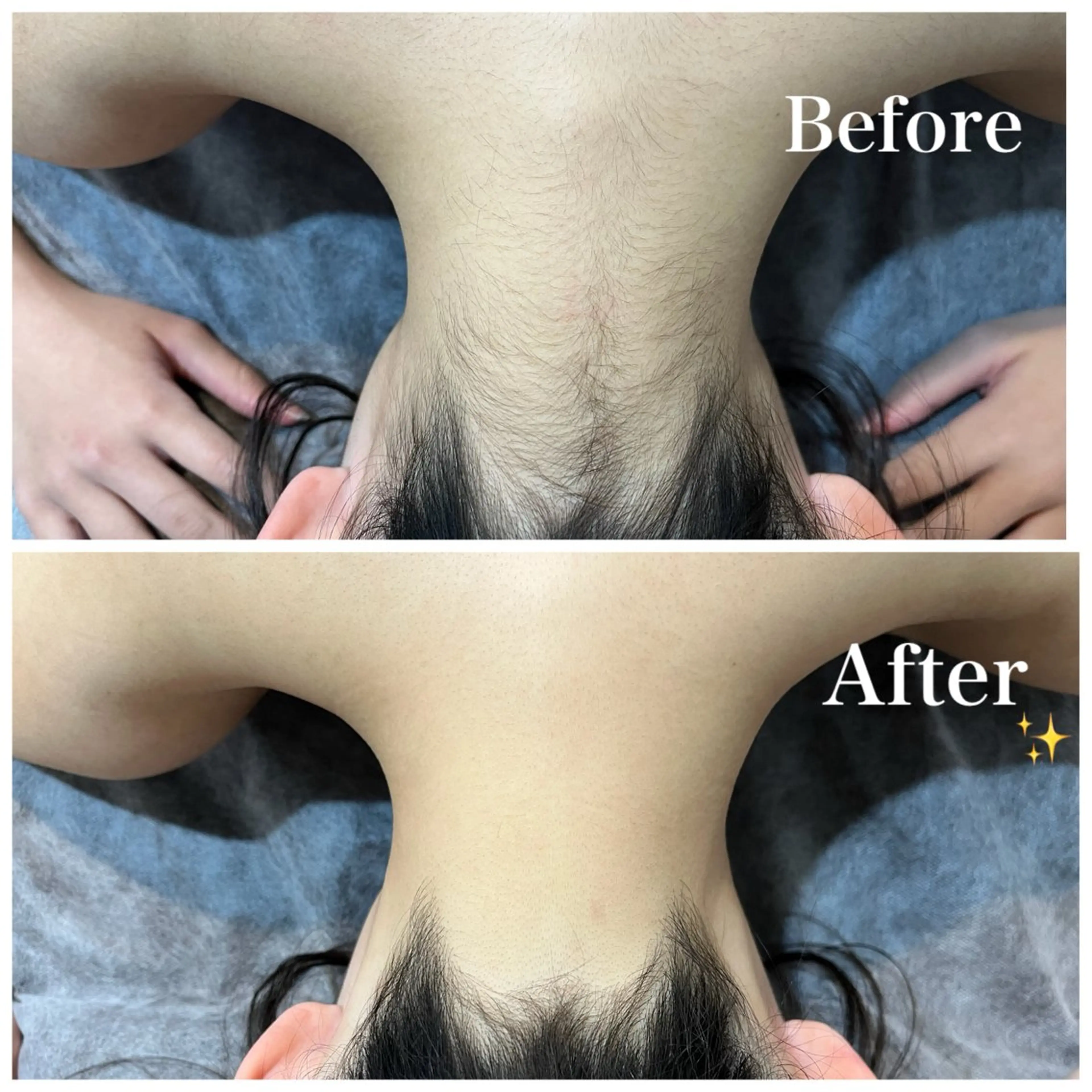 脱毛 脱毛サロン fam.豊澤柚良のエステ・リラクイメージ