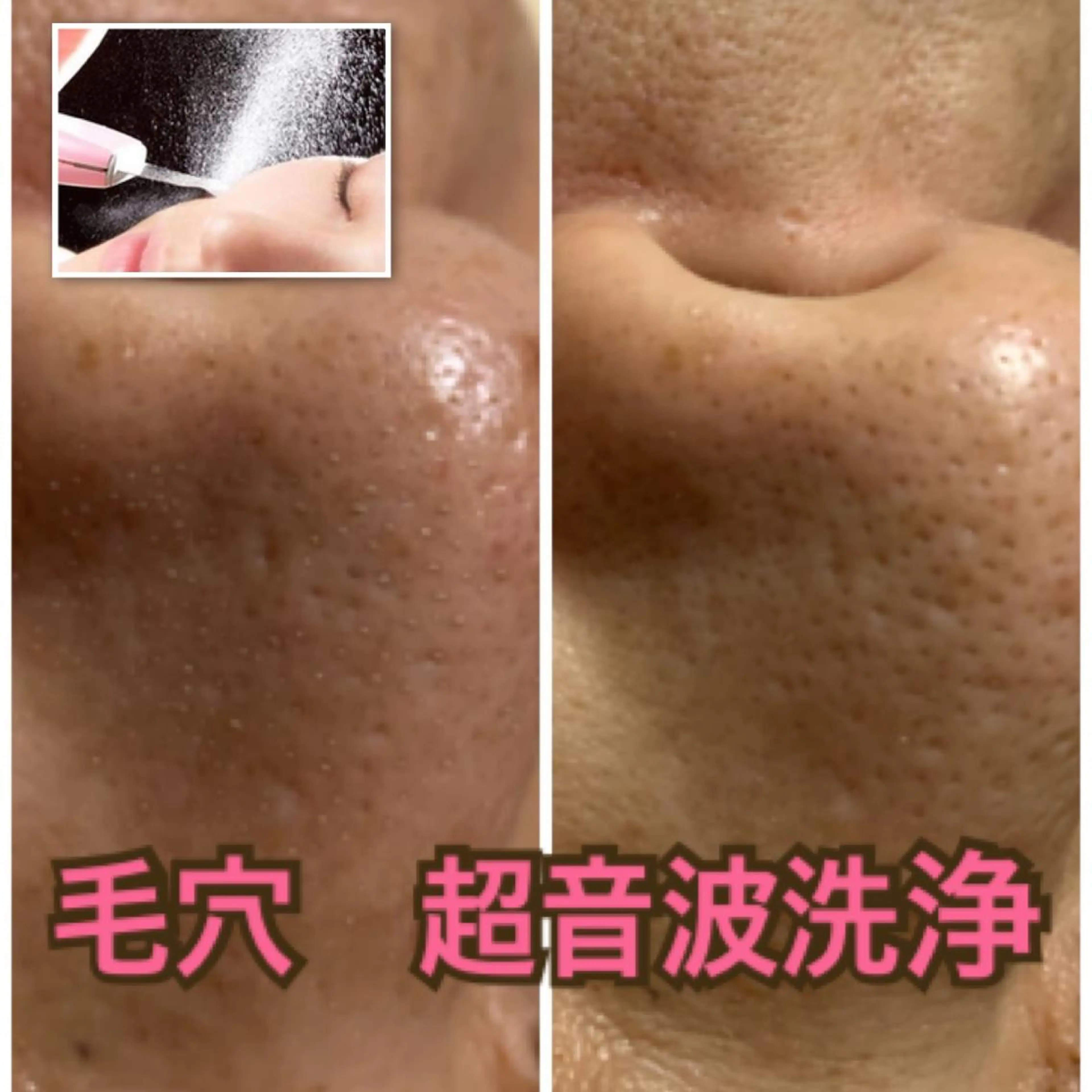 フェイシャルワックス 自然派エステファーノのその他イメージ