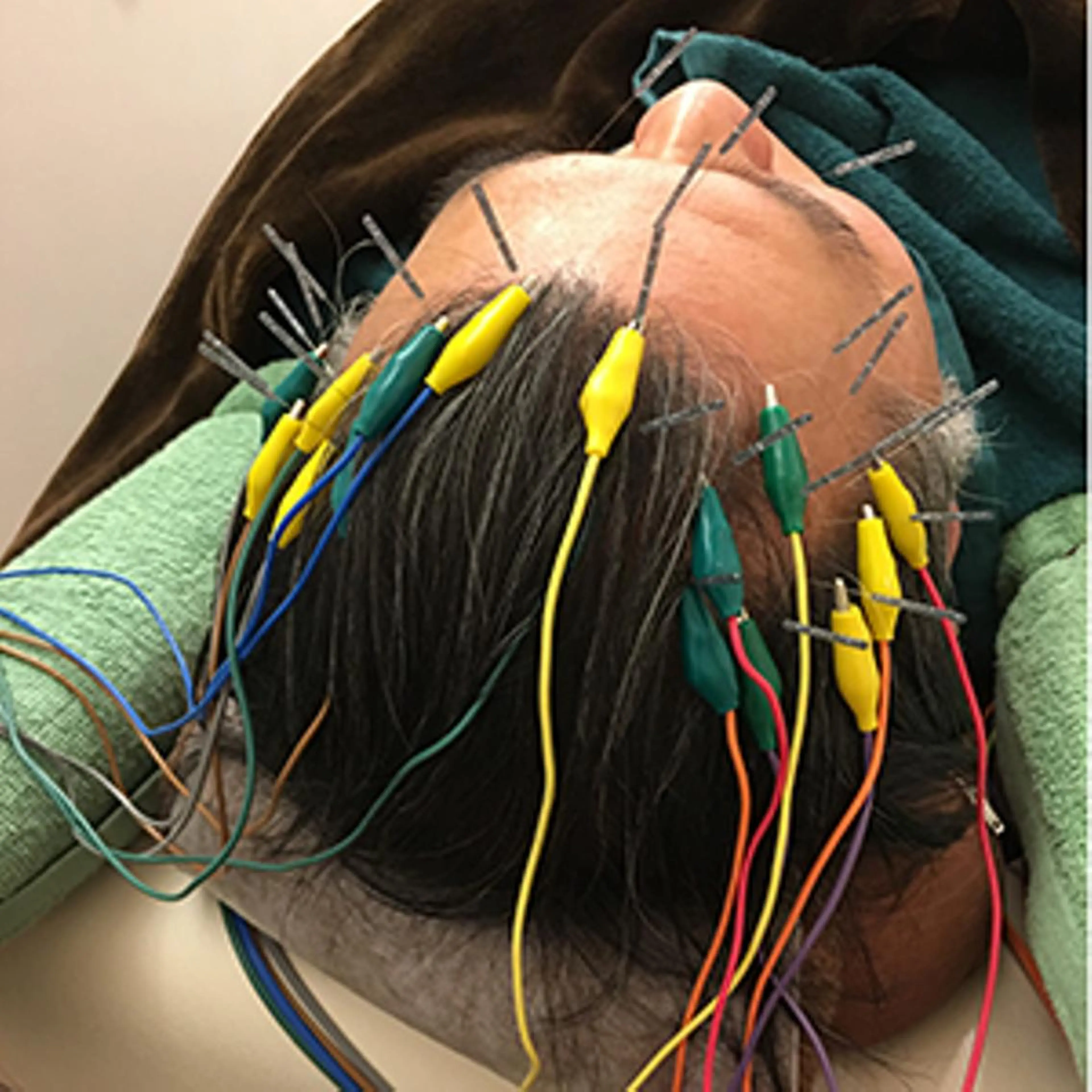 むくみたるみ専門☆ 美容鍼・小顔矯正のエステ・リラクイメージ