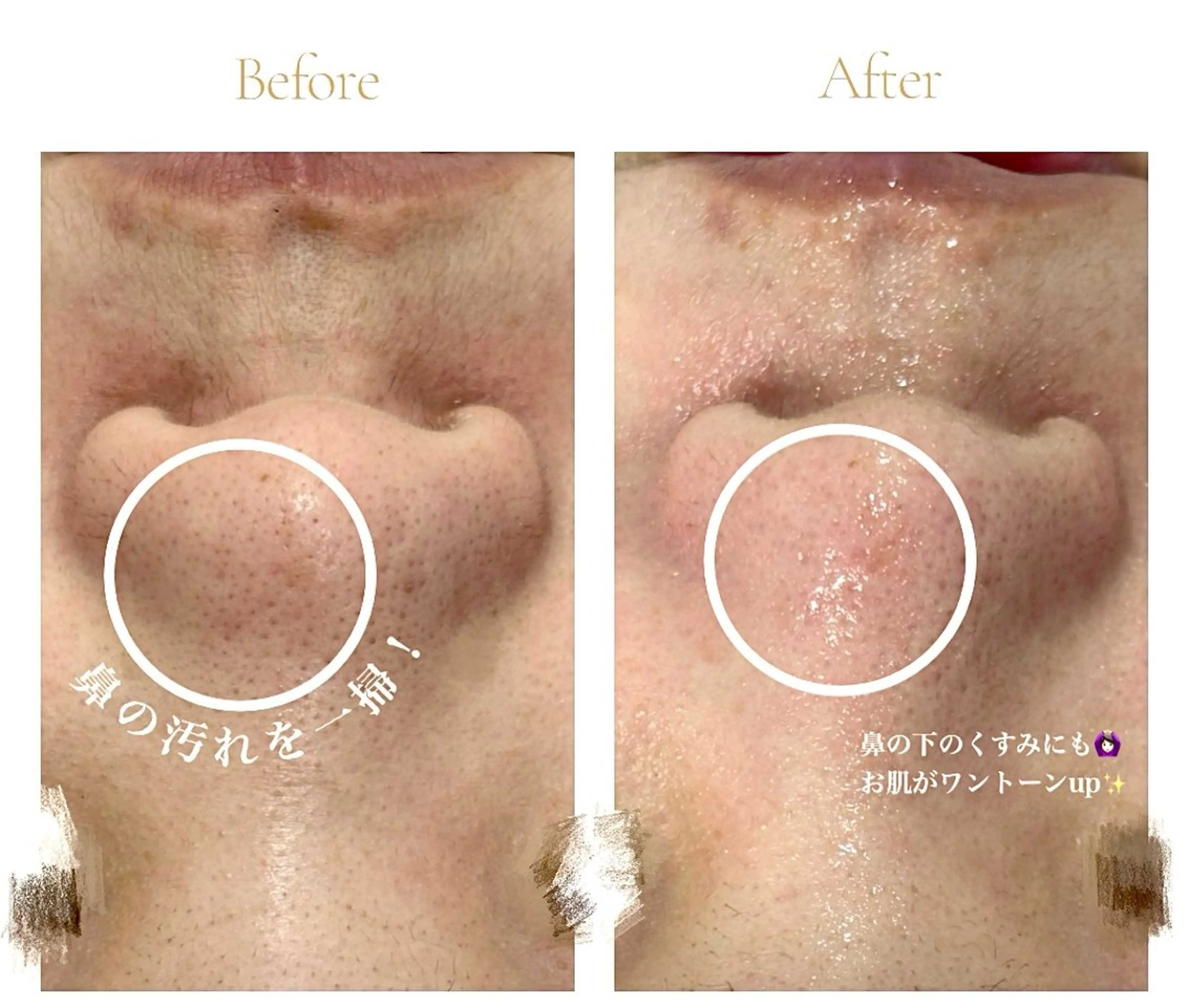 エステ 倉敷/玉島/20代 からの大人毛穴洗浄のエステ・リラクイメージ