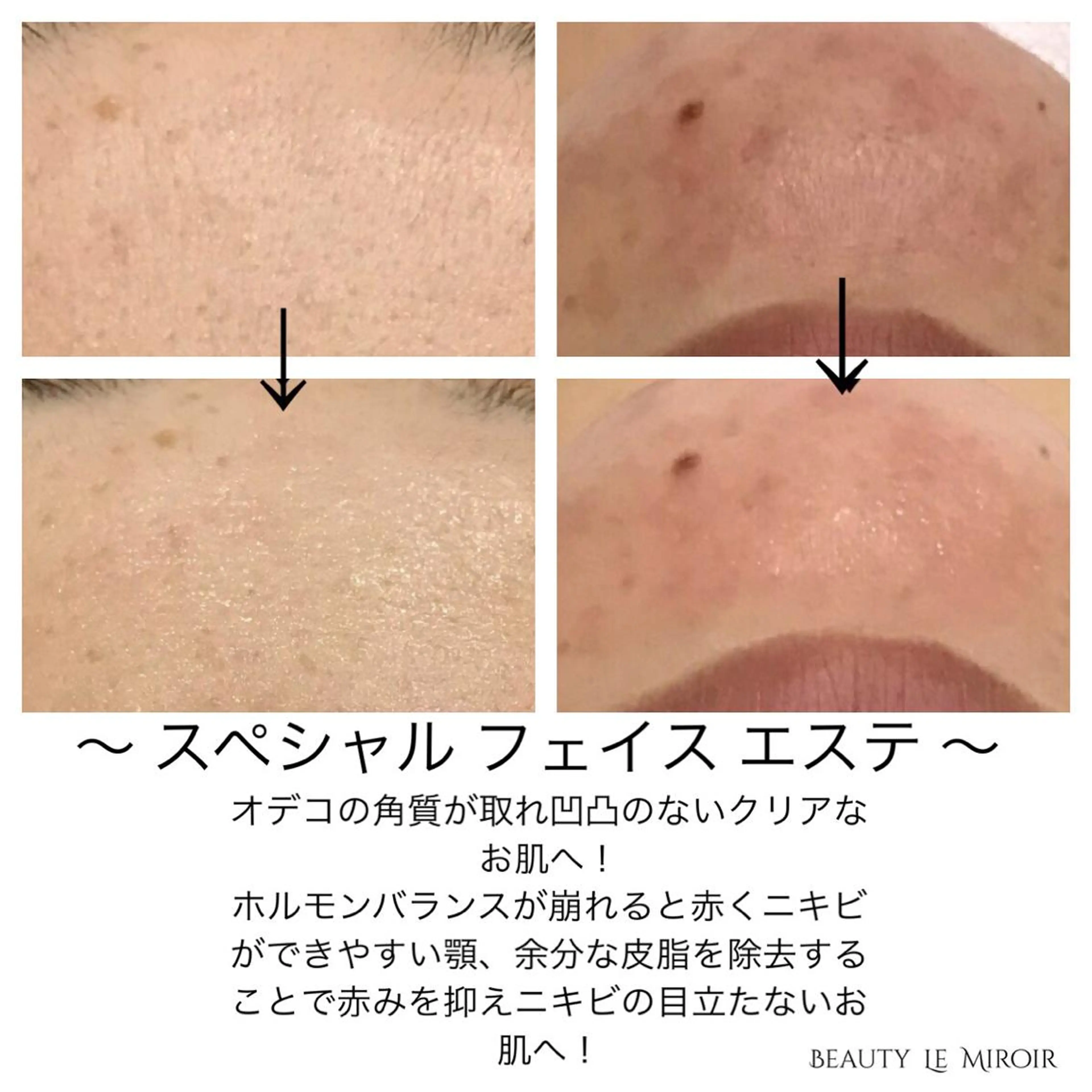 ビューティー ミロワールのエステ・リラクイメージ