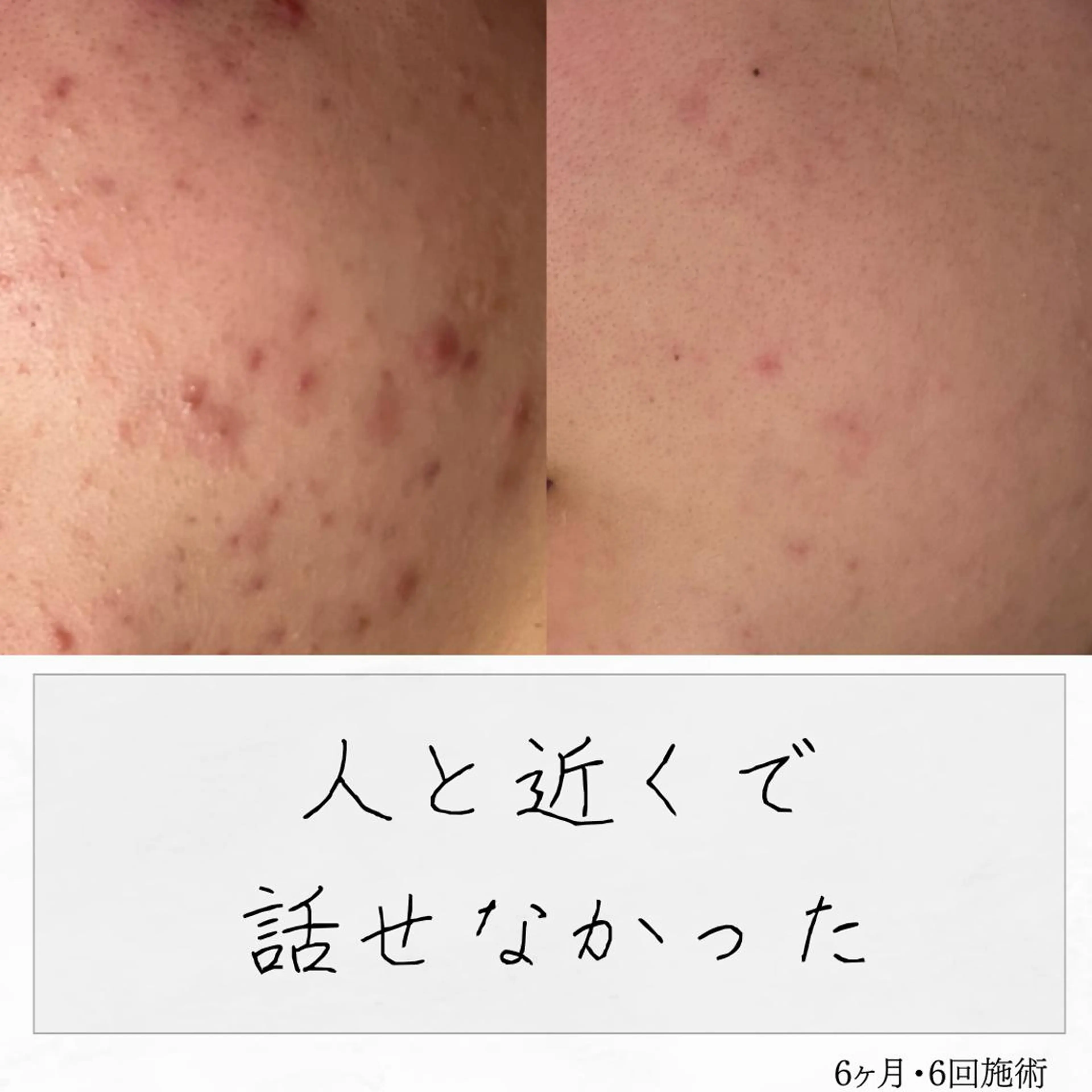 ニキビ経験者が施術 する専門サロン🌻のエステ・リラクイメージ