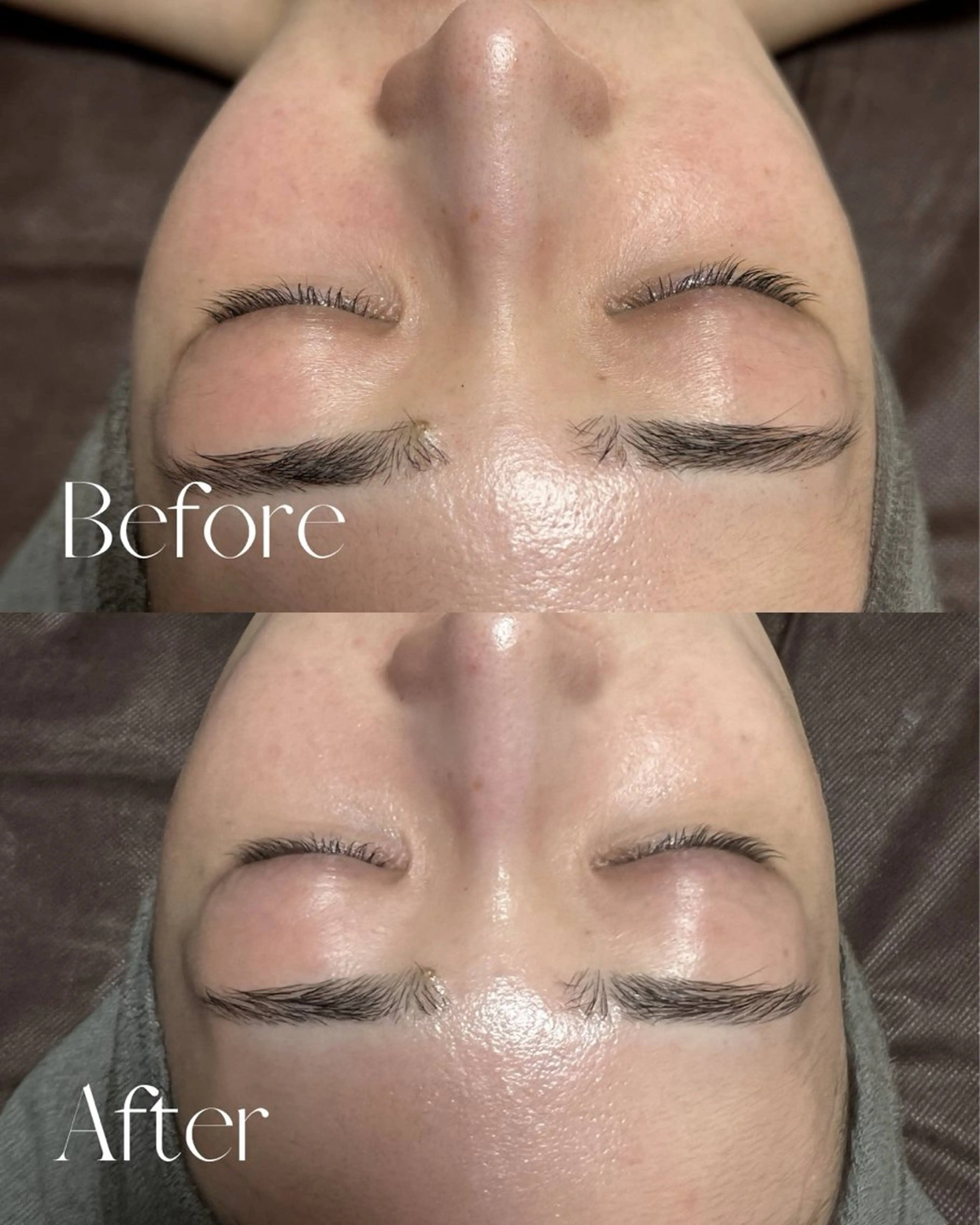 エステ シミ🩷ニキビ専門店 Matteo🎀✨のエステ・リラクイメージ