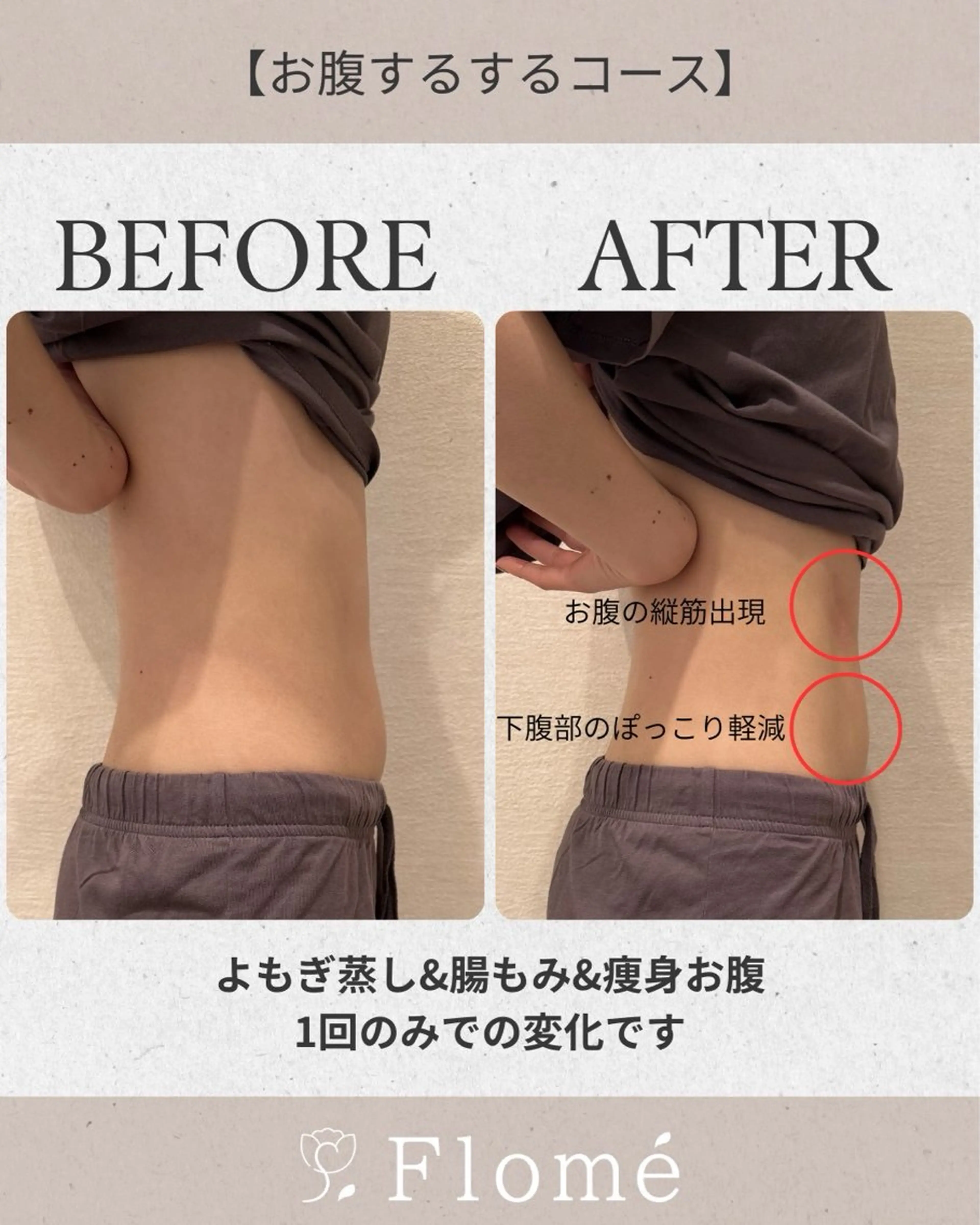 【人数限定】腸活くびれコース🎀よもぎ蒸し→腸もみ→機械(お腹)→耳ツボジュエリーの写真