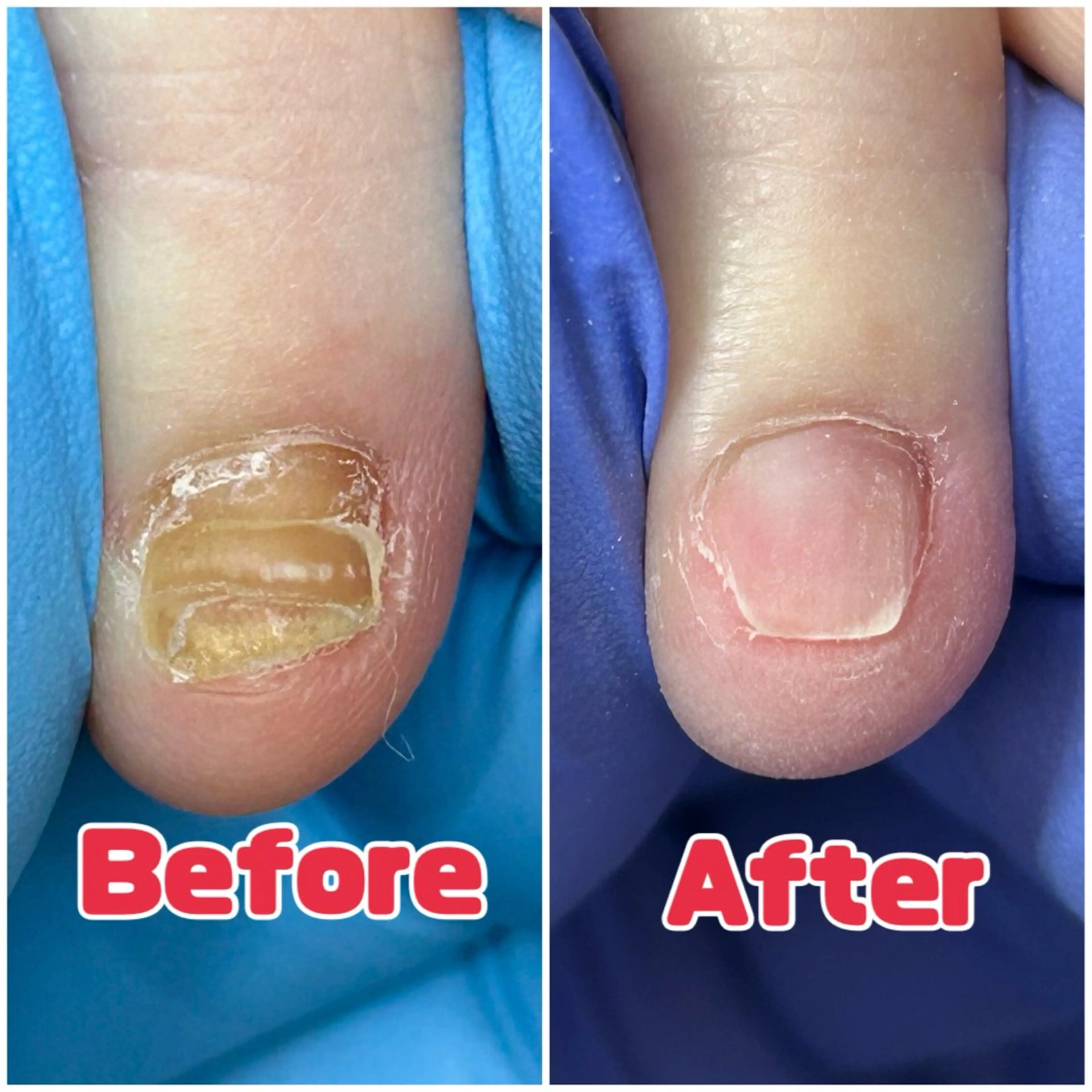 巻き爪補正店　柏店所属・巻き爪補正店 柏店のその他イメージ