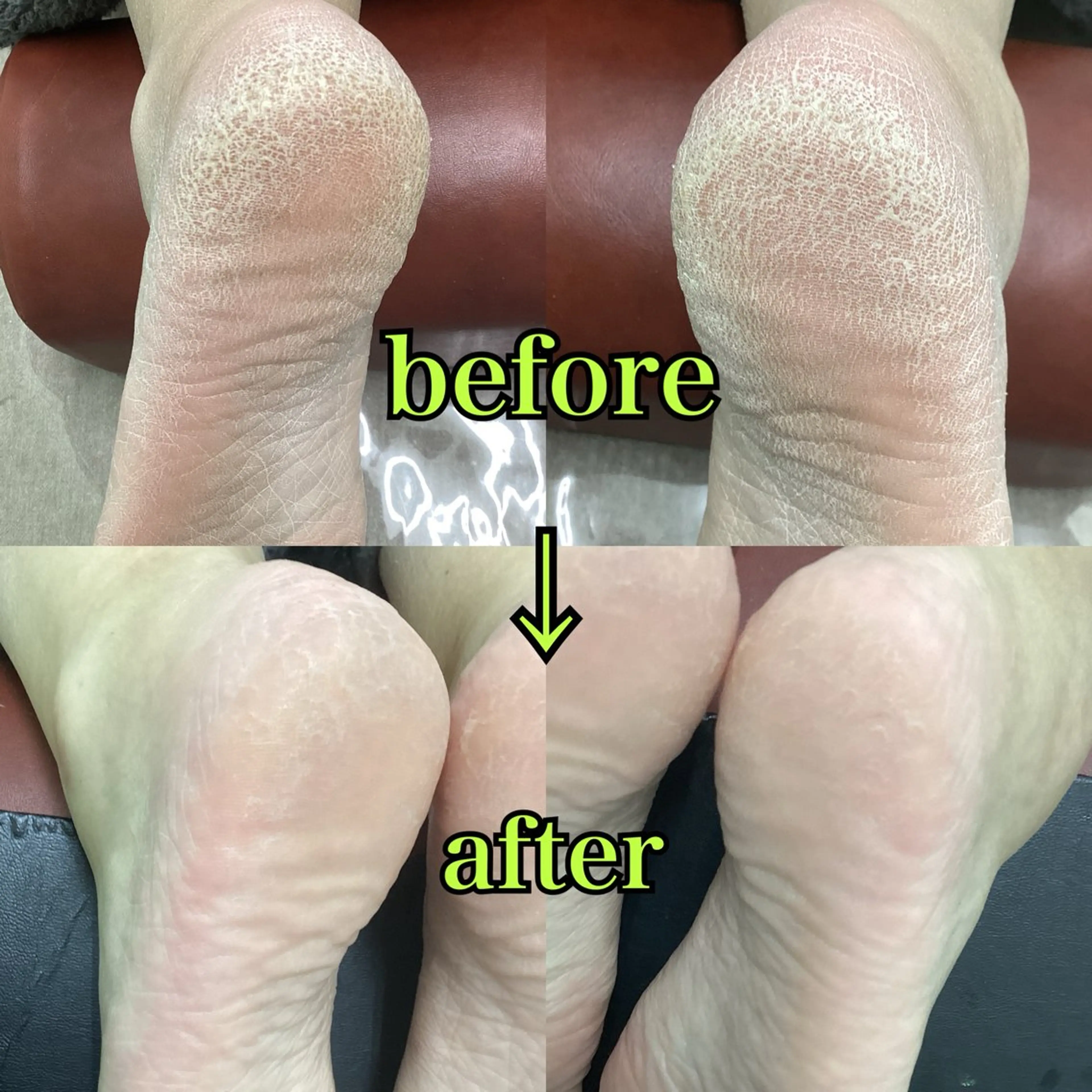 リラク リラク/ネイル/ 足裏ケア/蛭川栞のエステ・リラクイメージ