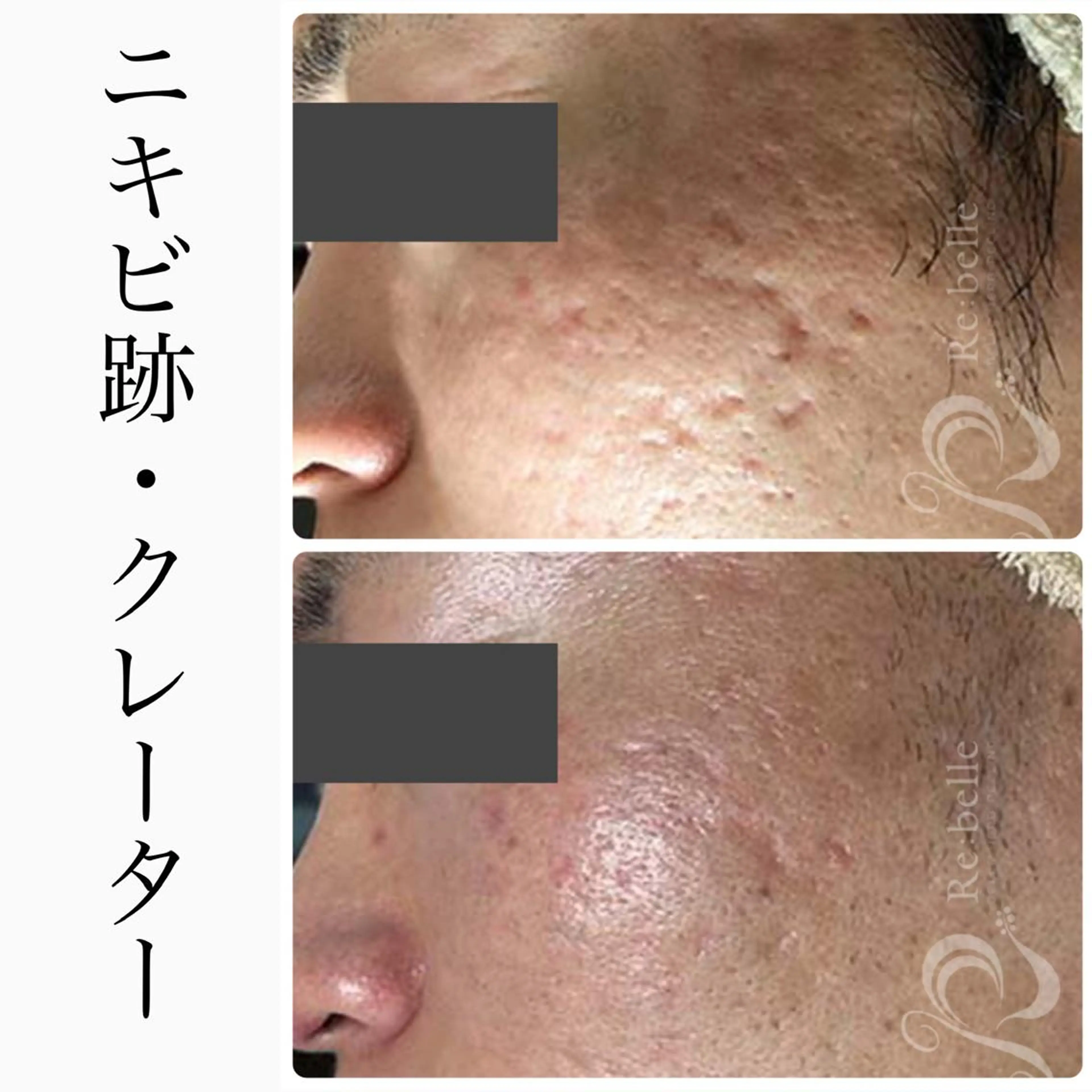 エステ ハーブピーリング専門 BIOEL横浜のエステ・リラクイメージ