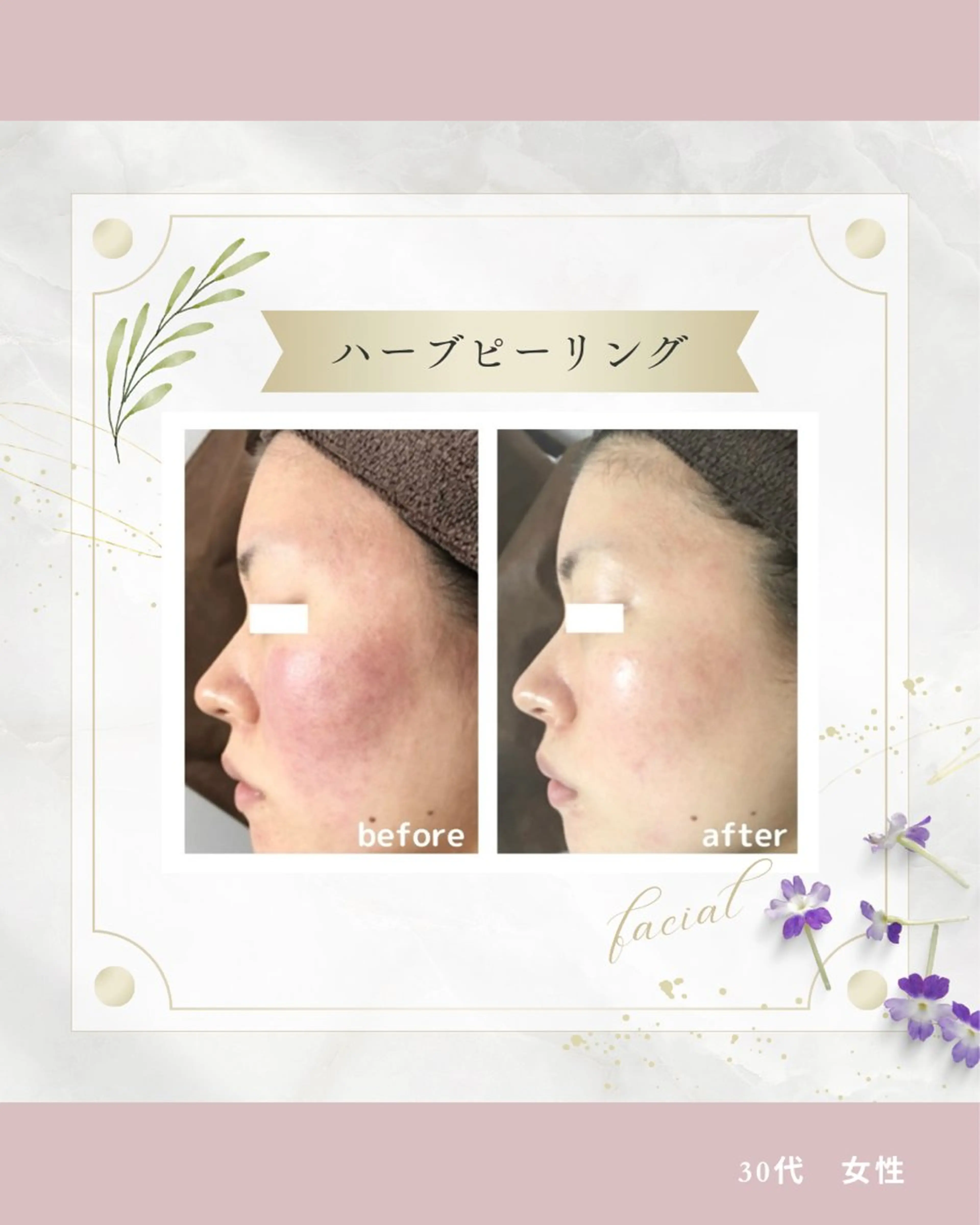 《 肌質×美肌 》 addissimoのエステ・リラクイメージ