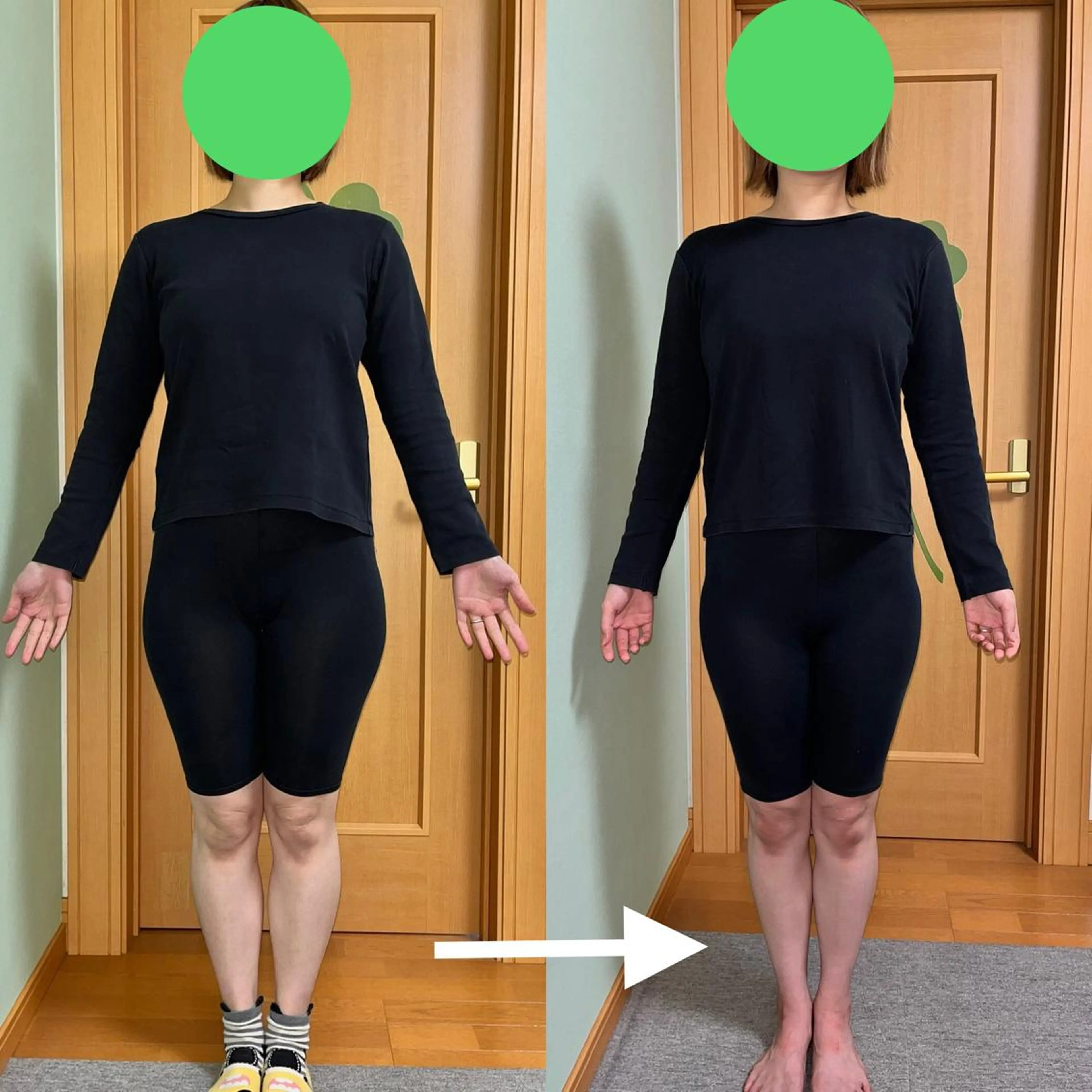 学生さん必見!ミニモ学割【U24学割】大転子スッキリ小尻化へ✨骨盤矯正60分2000円の写真