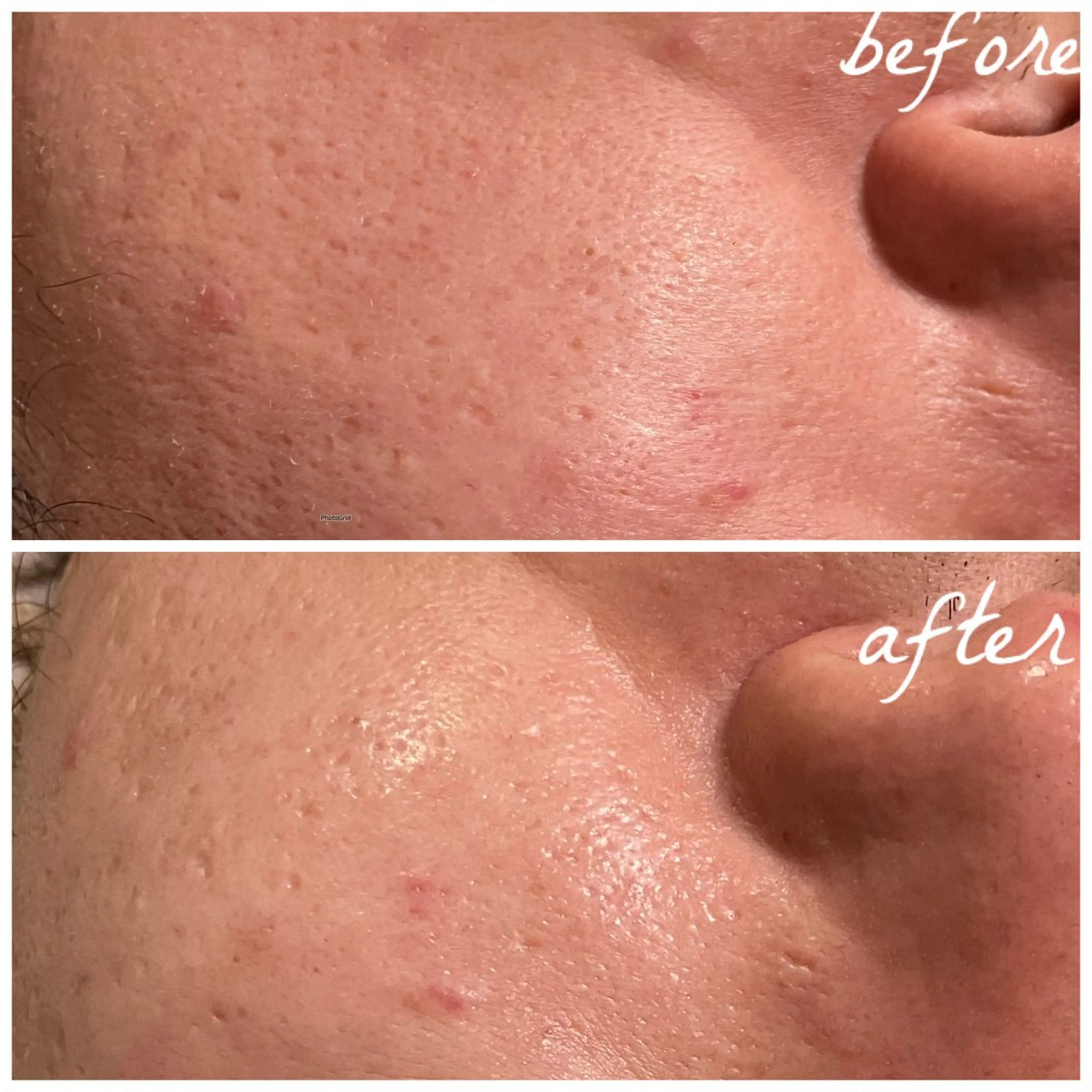 メンズ メナード岐阜茜部 杉浦のエステ・リラクイメージ