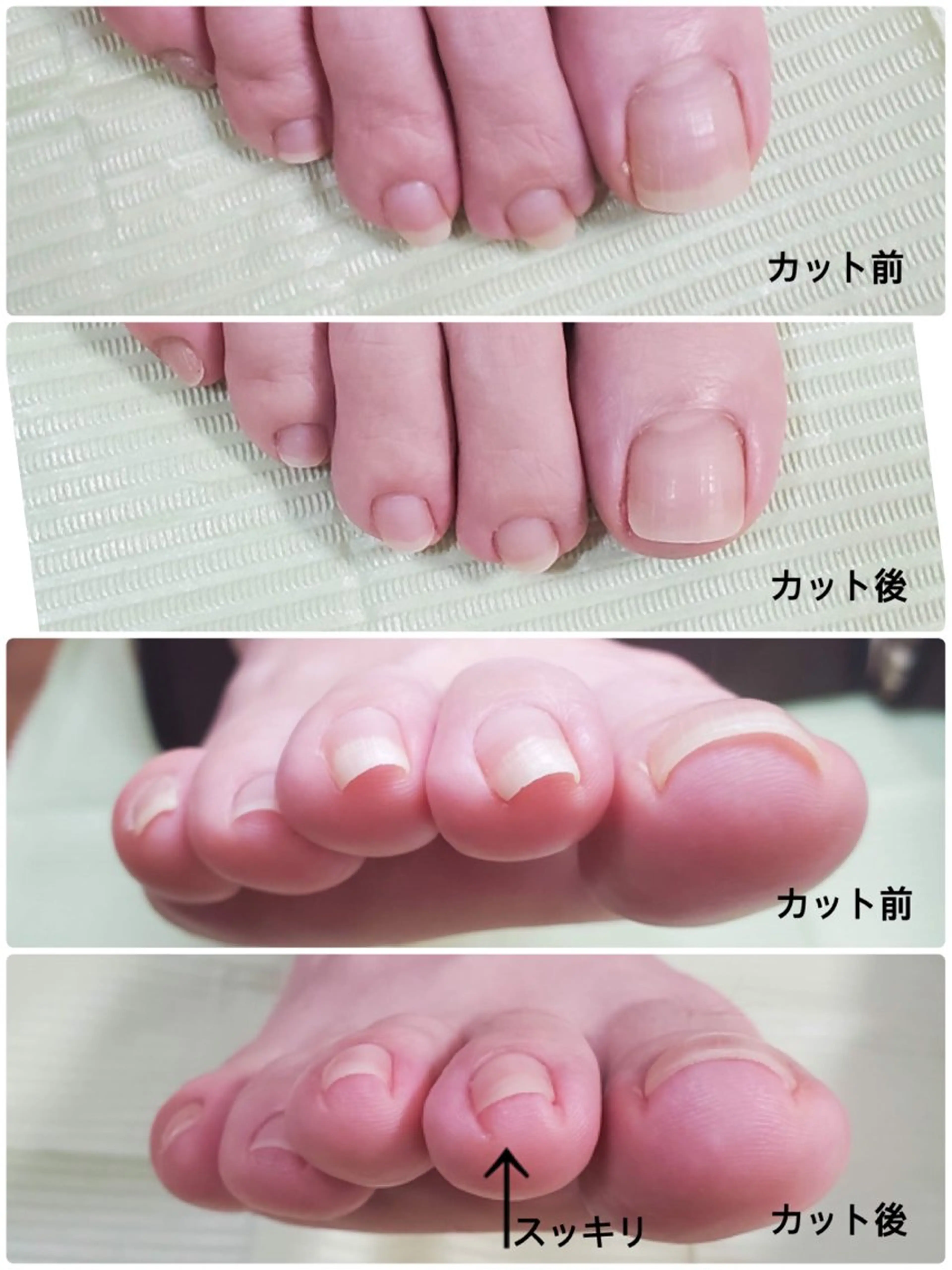 ネイル フットネイル ネイリスト モリシタのネイルデザイン