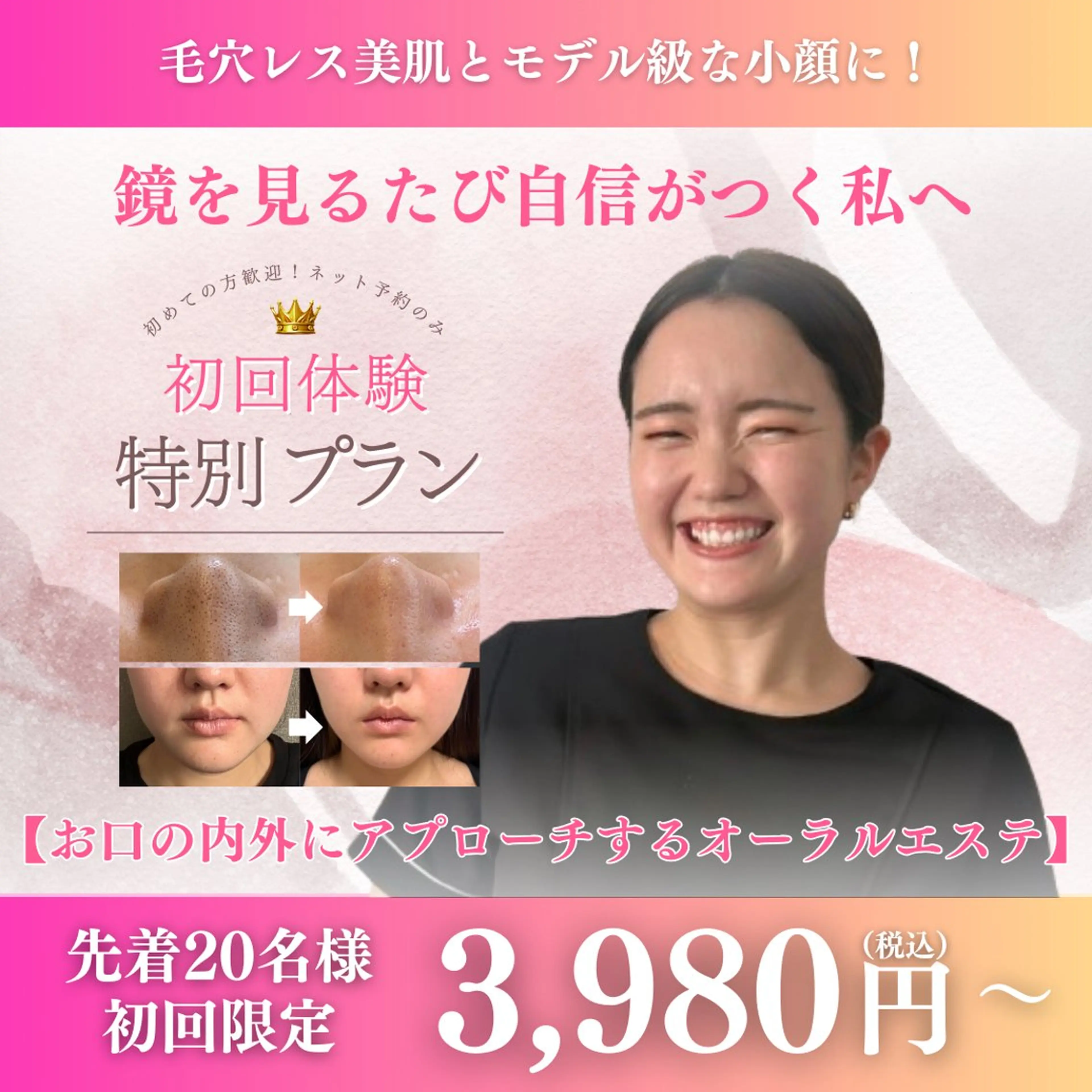 肌質改善・小顔サロン 20代店長RINNAのエステ・リラクイメージ