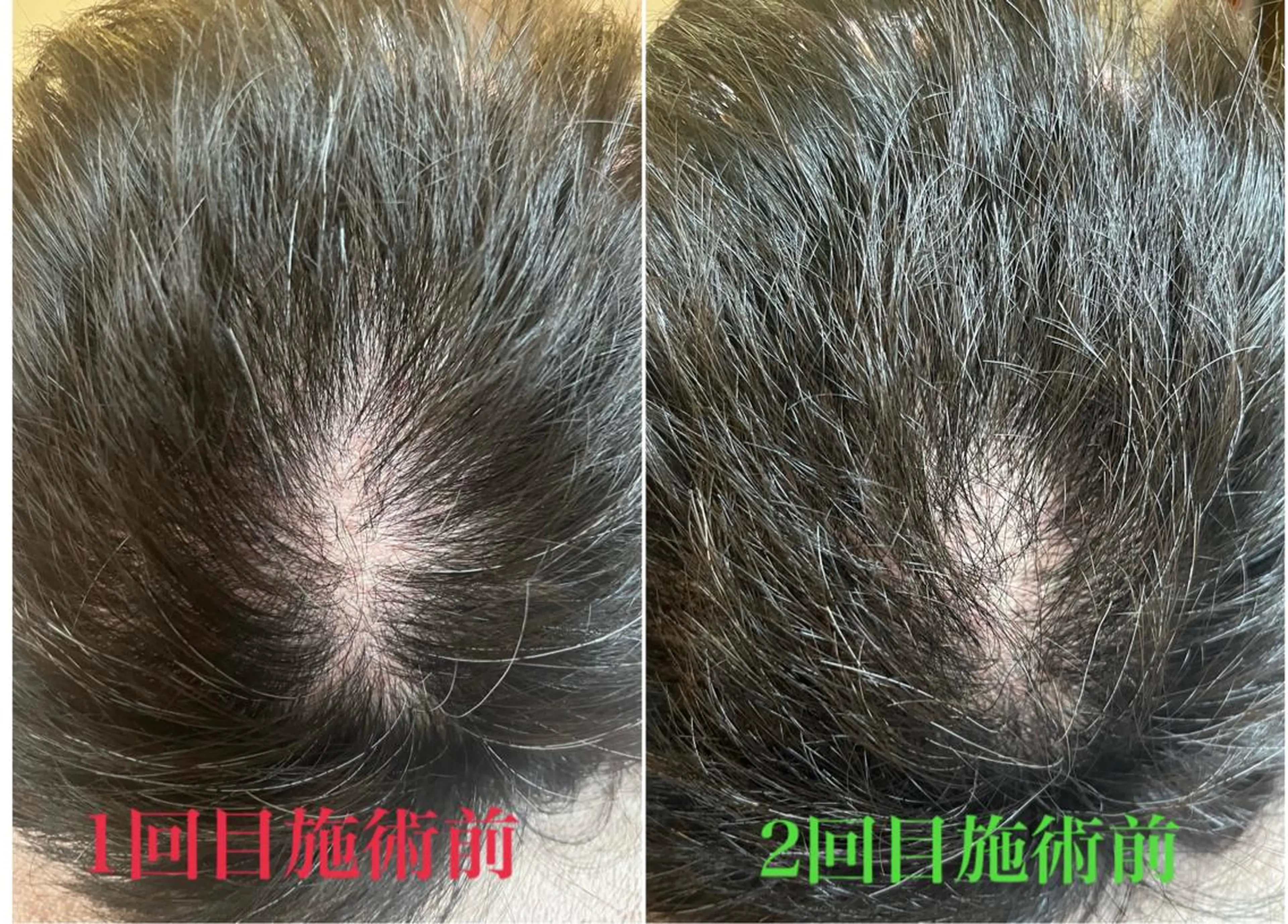 アロマ･美容鍼･カッ ピング「麗」鍼灸院のエステ・リラクイメージ