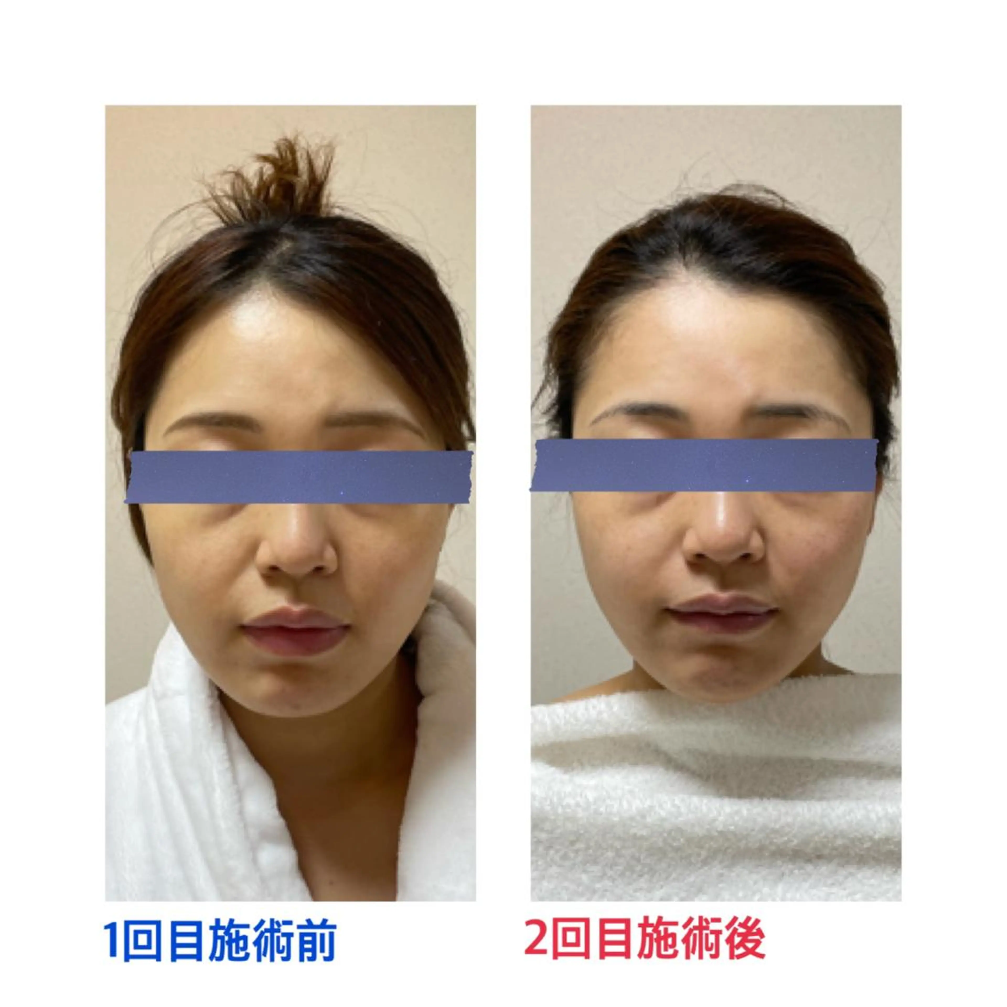 エステ リラク プライベートサロン moyoのエステ・リラクイメージ