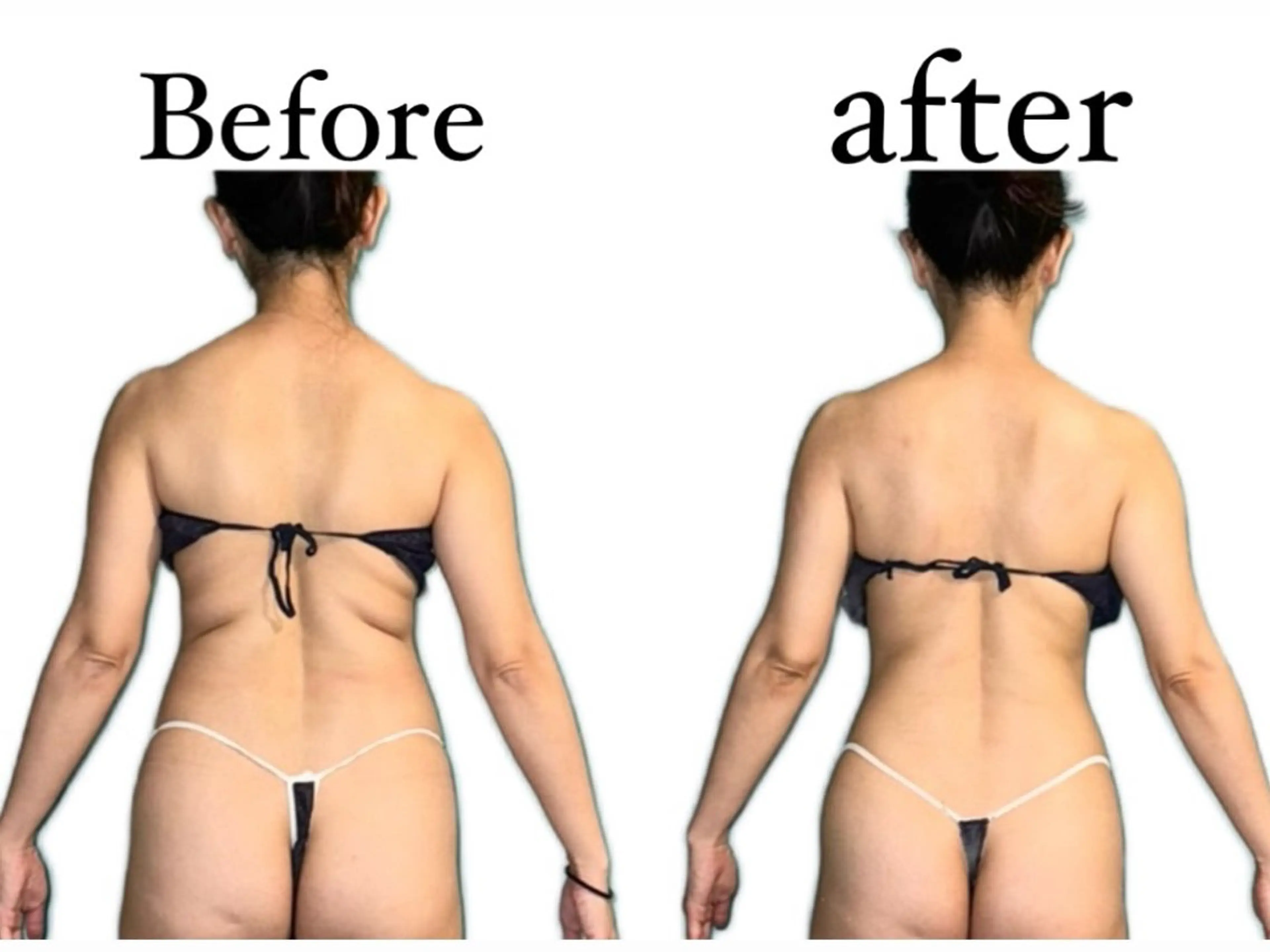 慢性的な首肩こり背中のハリや疲れ上半身の重だるさを改善する『全身ケア』の写真