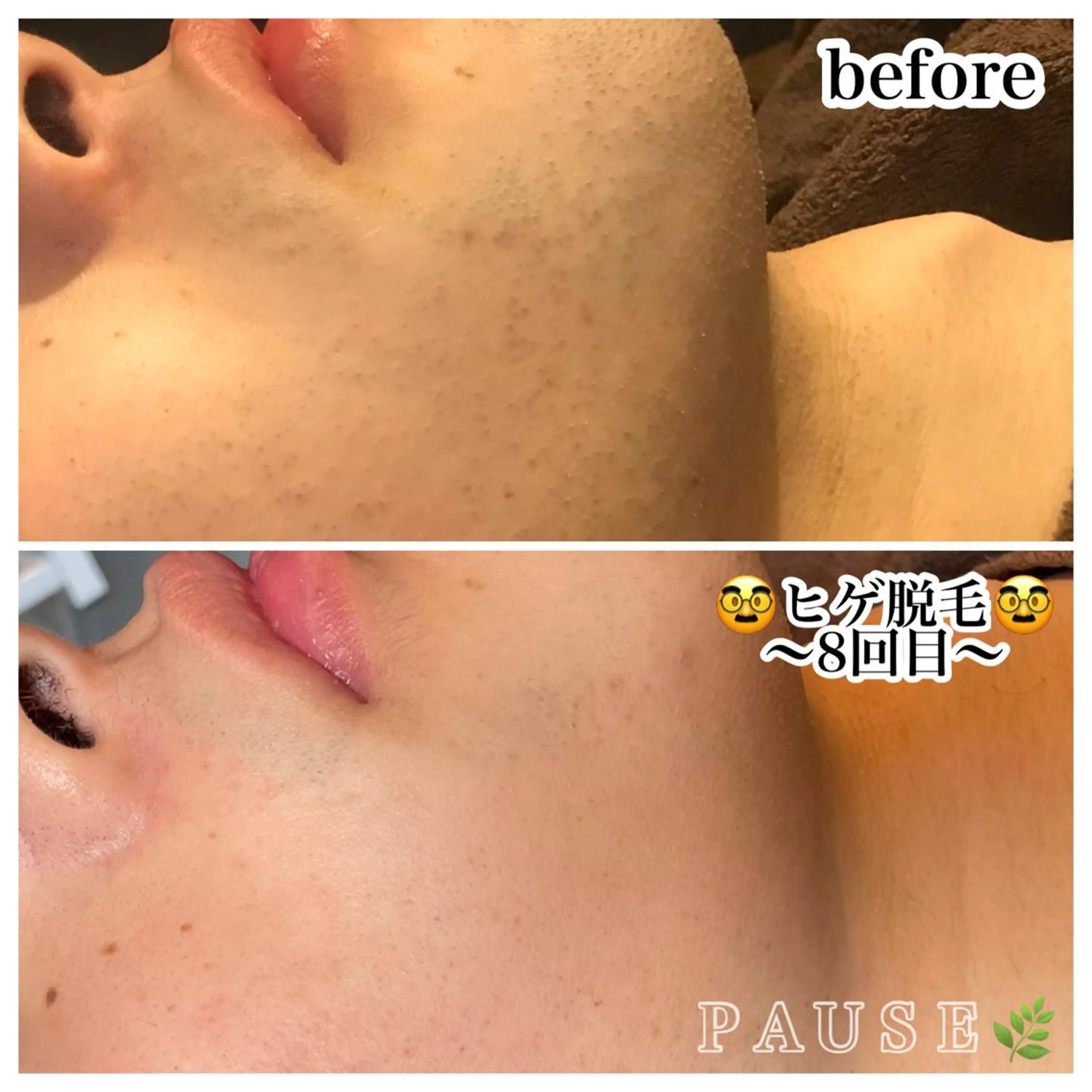 脱毛 浜野 恵美のエステ・リラクイメージ