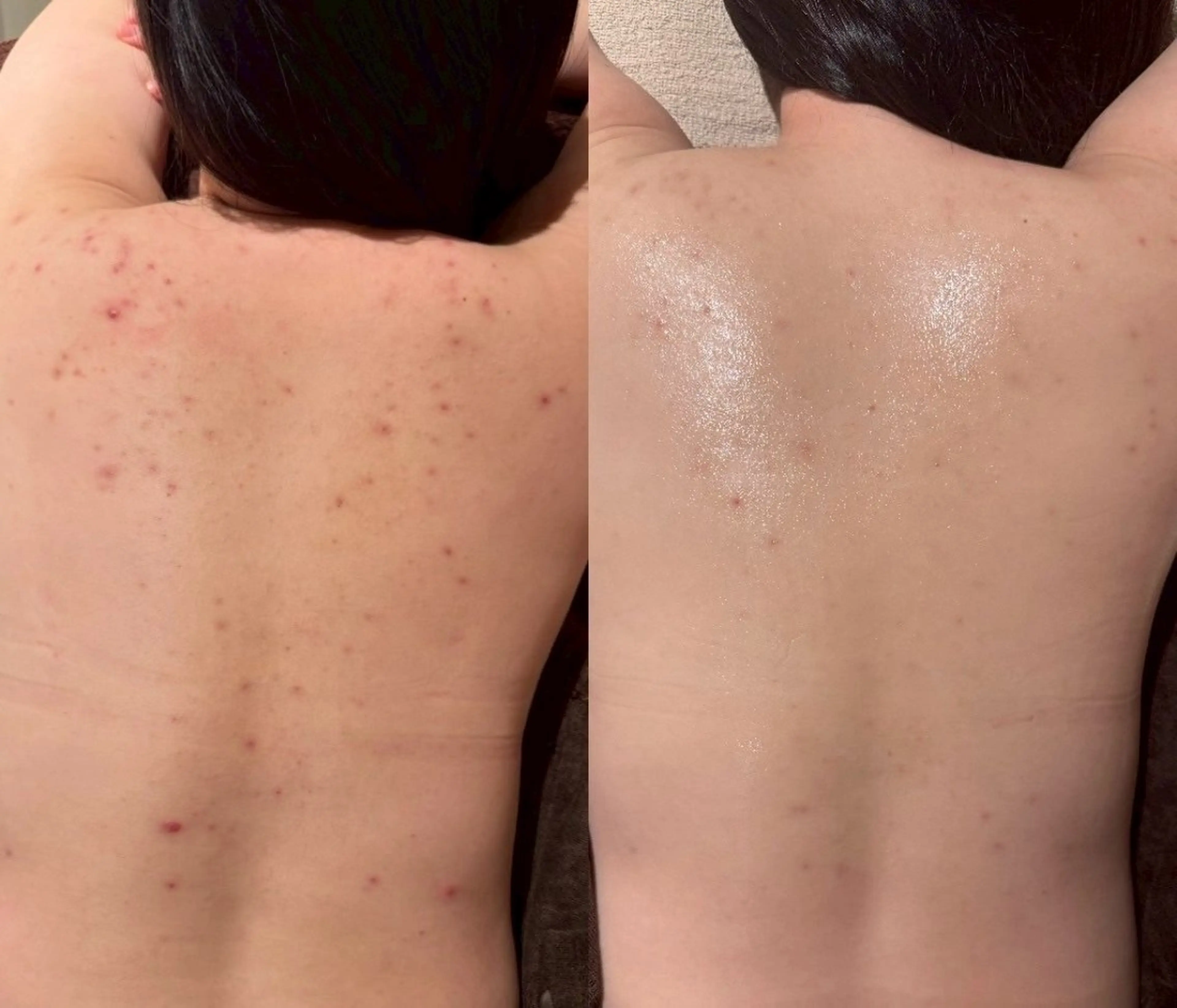 その他 for woman所属・森 美優のエステ・リラクイメージ