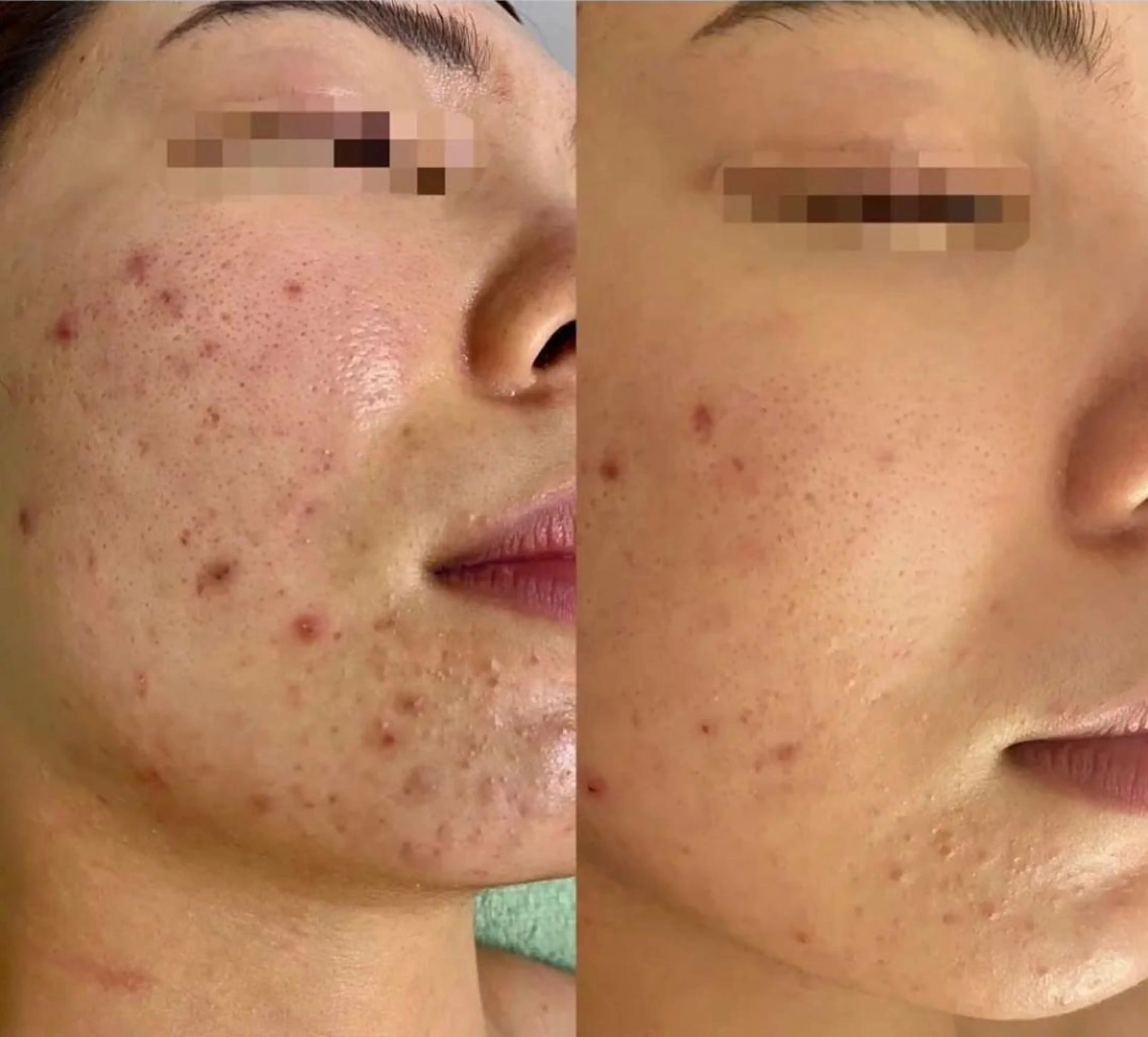 美肌ケアサロン iru【アイル】のエステ・リラクイメージ