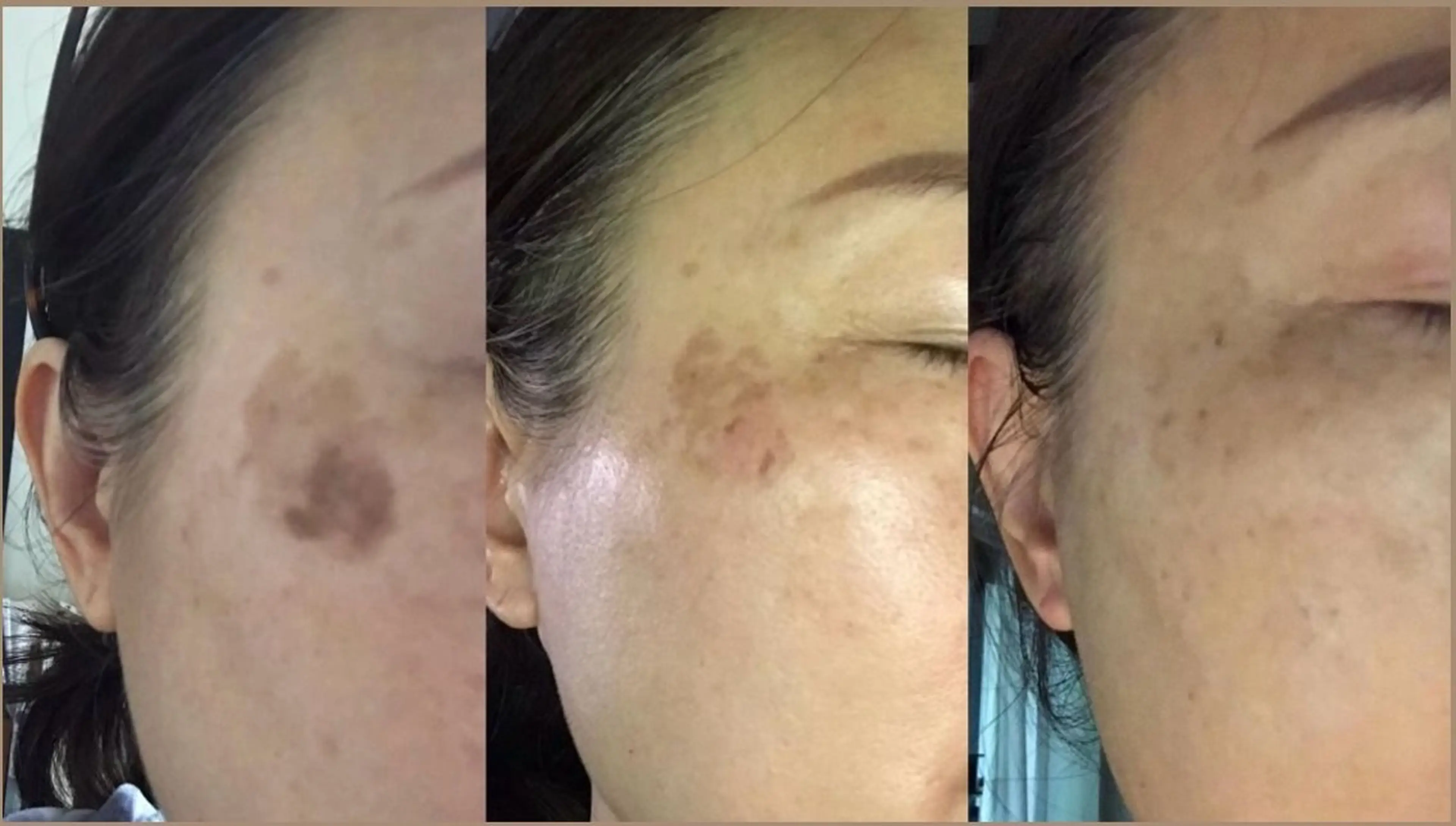 メンズ脱毛サロン BRIGHTのエステ・リラクイメージ