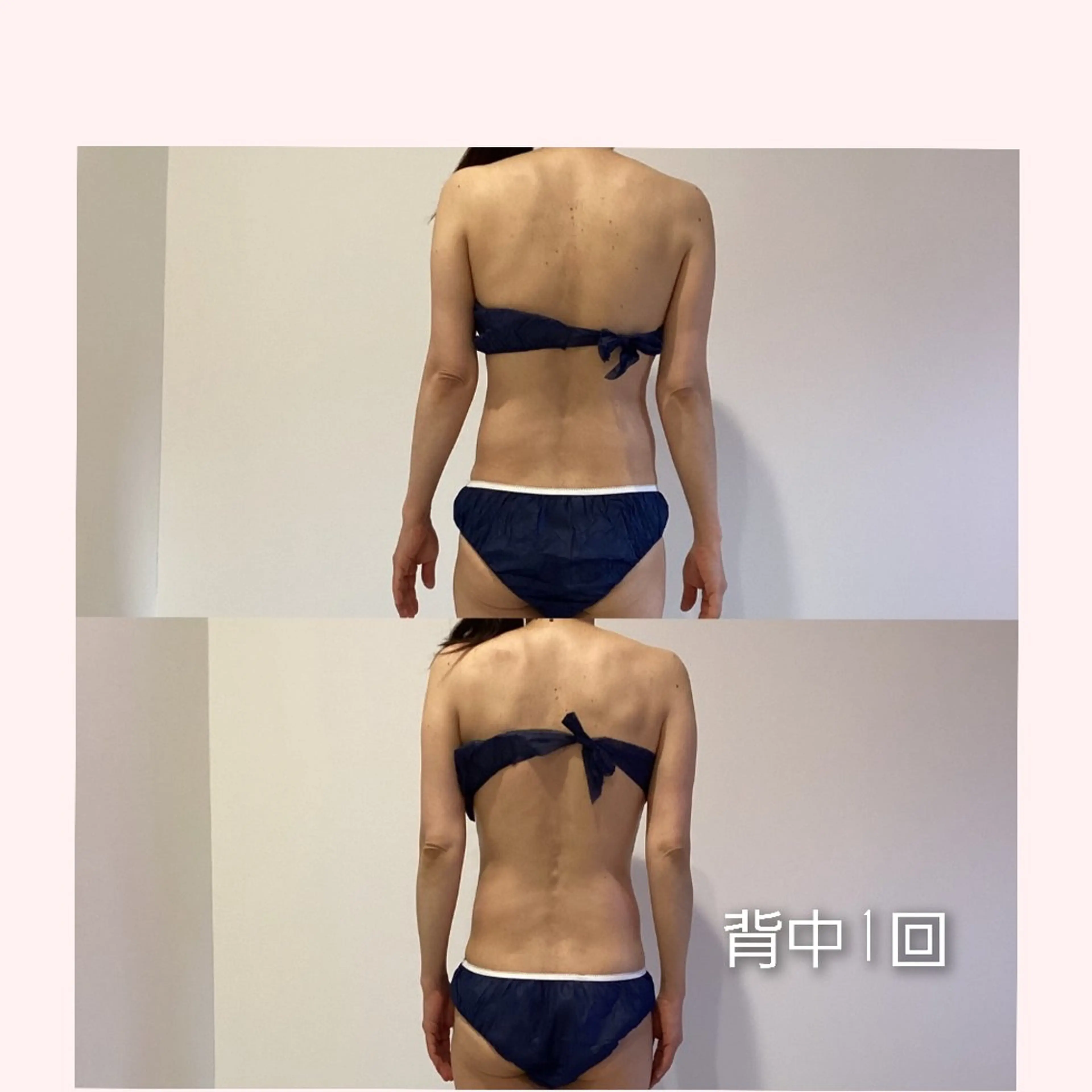 初回の方今だけお得！フォースカッター痩身60分(2部位)15,400円→5000円の写真