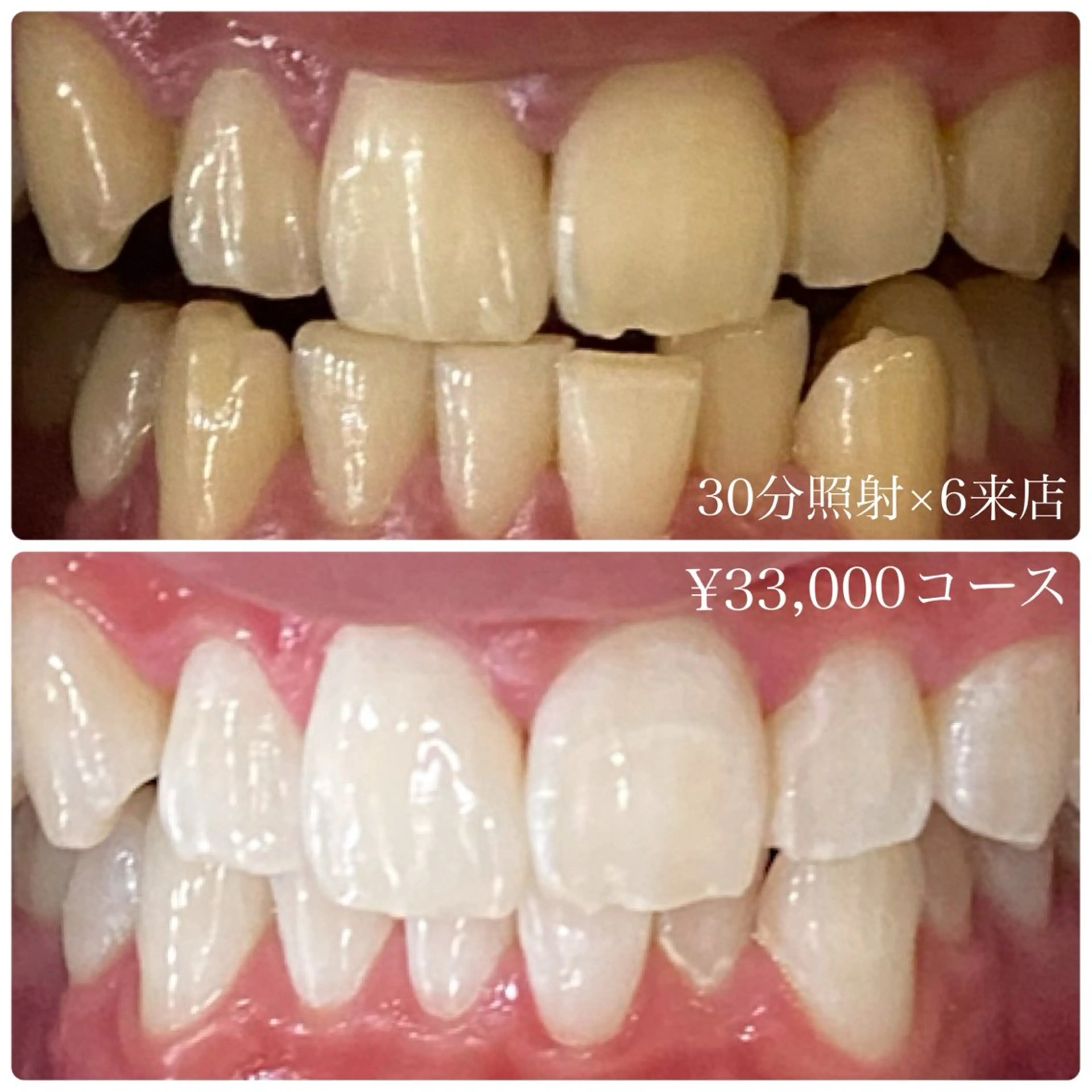 メンズ ホワイトニング ルーム　川崎店のその他イメージ