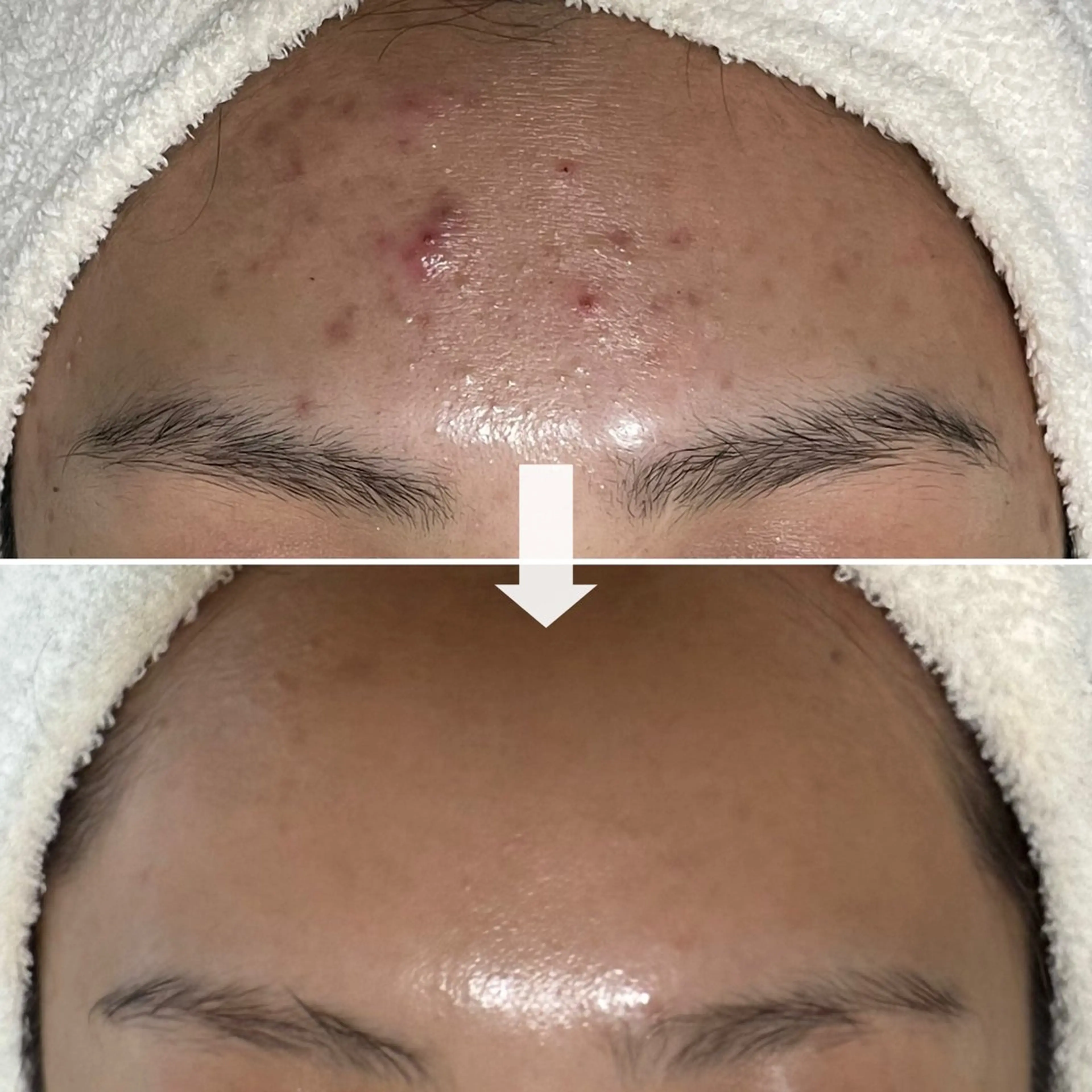 エステ ニキビ・毛穴・ フェイシャル専門店のエステ・リラクイメージ