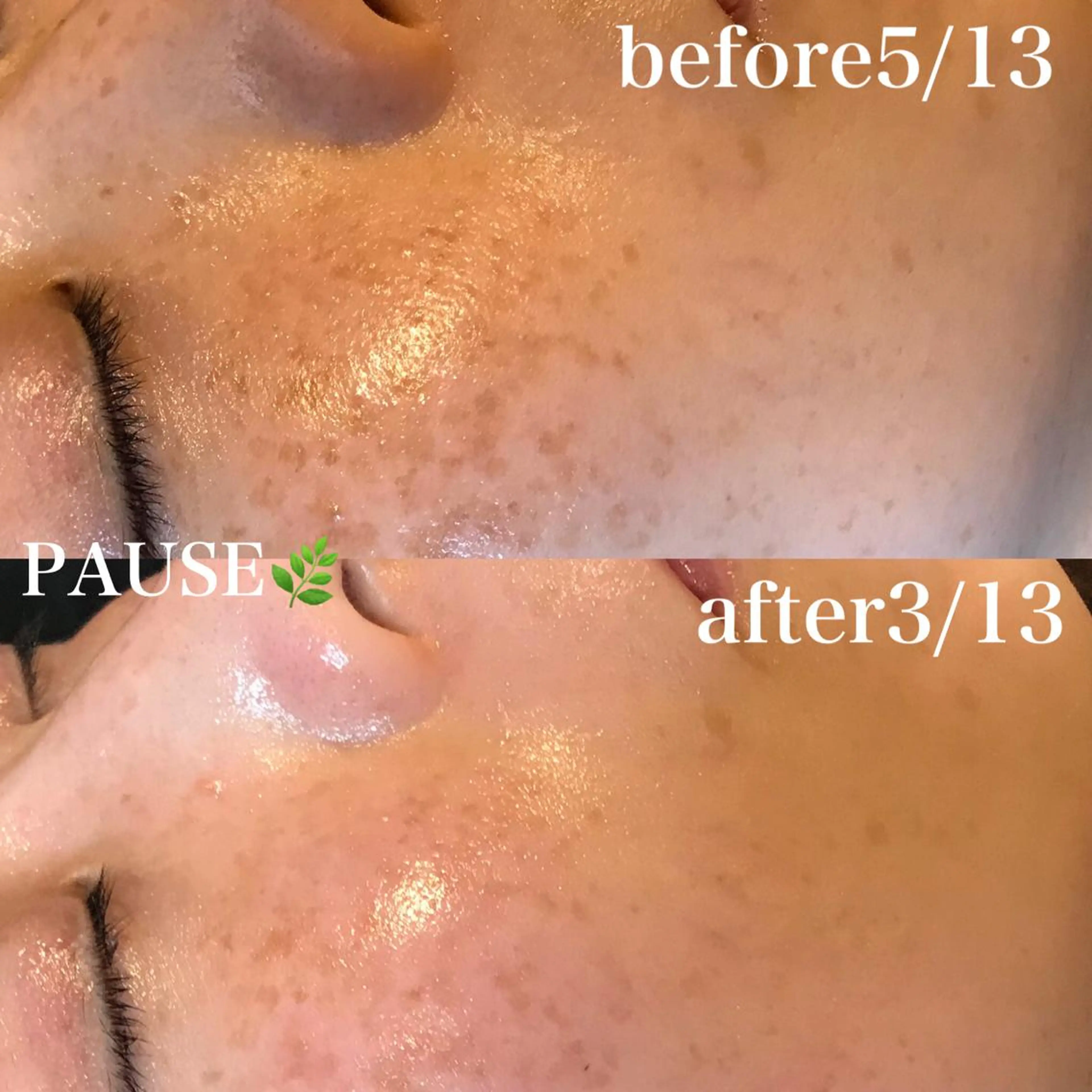 エステ 浜野 恵美のエステ・リラクイメージ