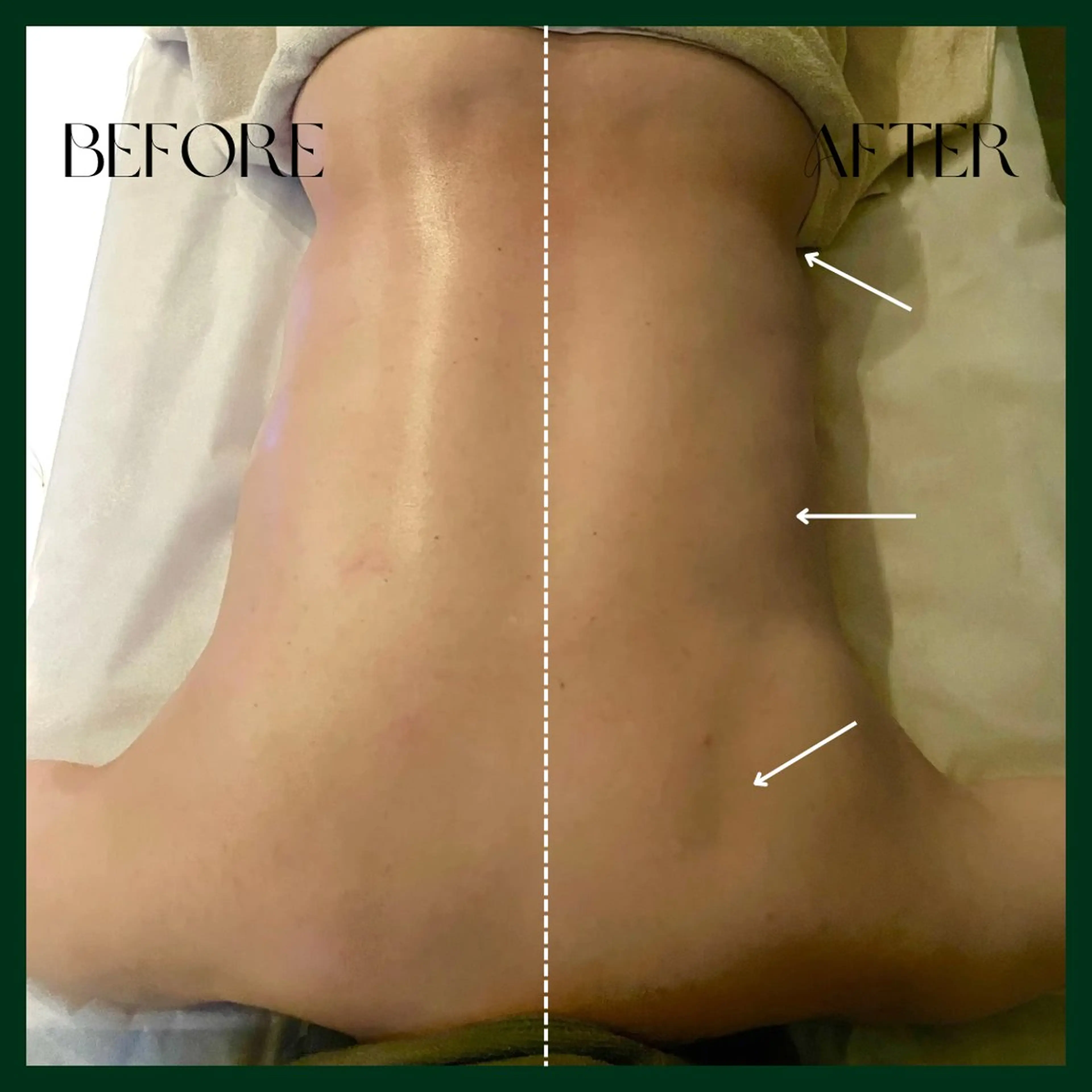 オフ:オン 全身筋膜マッサージのエステ・リラクイメージ