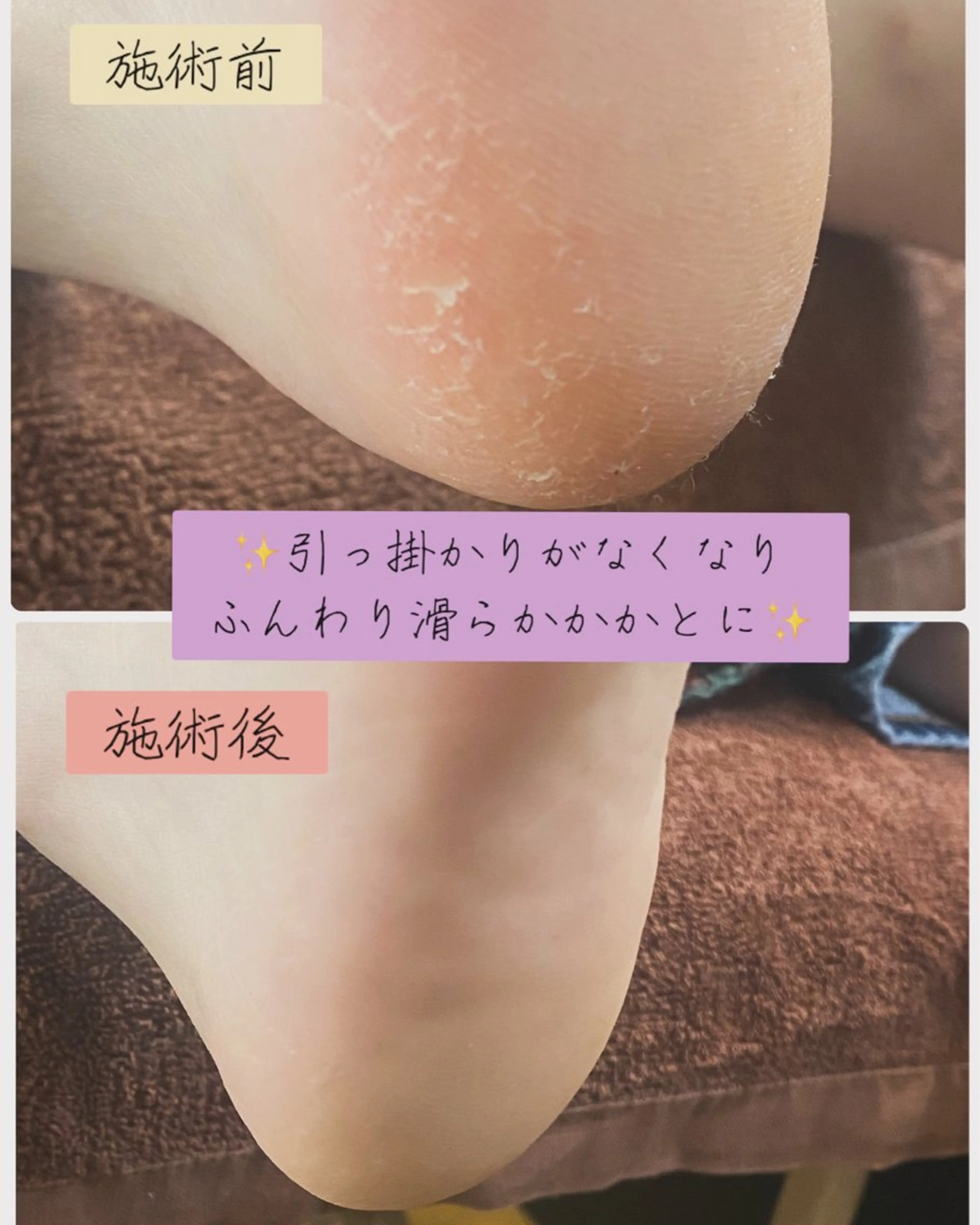 ネイル フットネイル フットネイル Studio Jivanのネイルデザイン