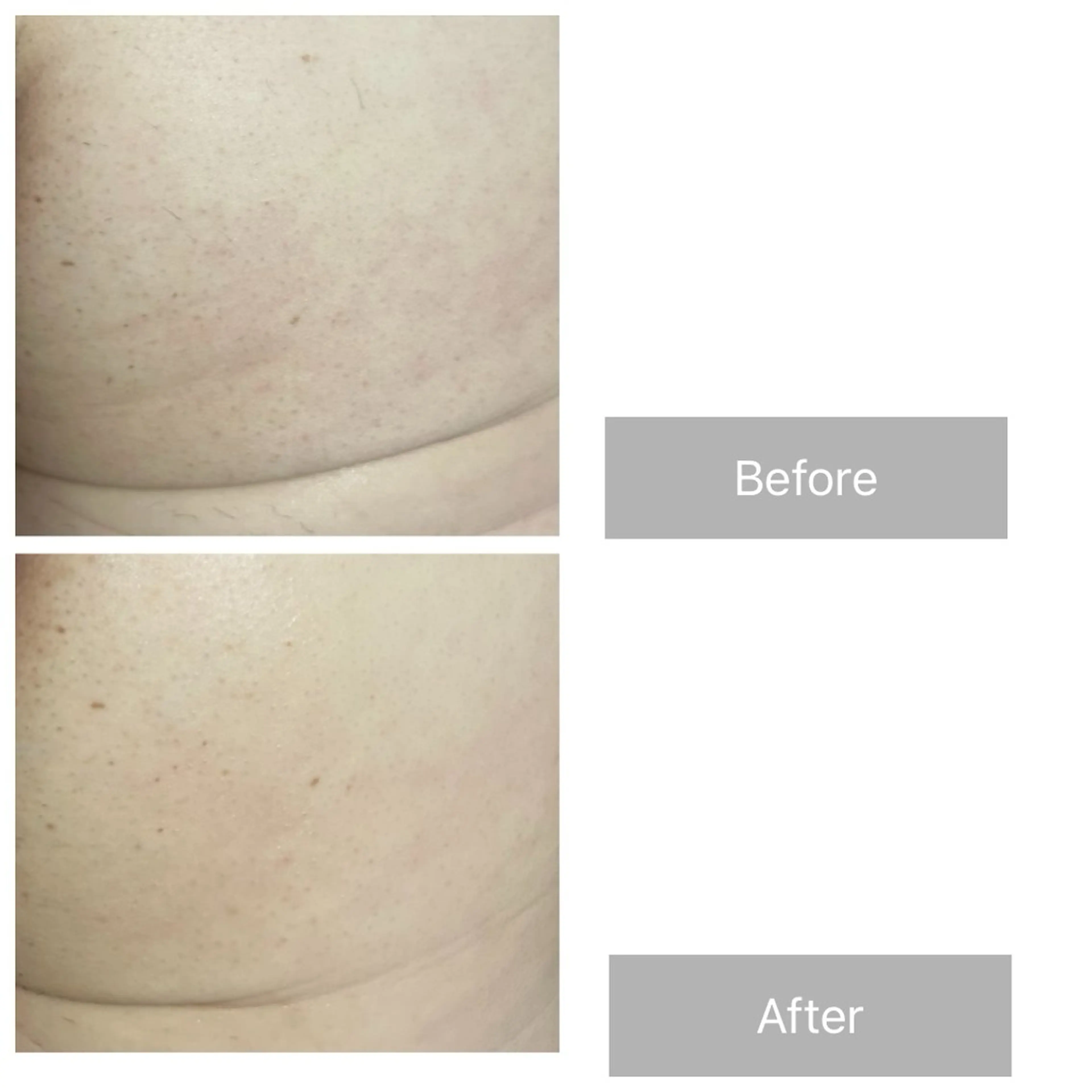 メンズ エマニエル USAのエステ・リラクイメージ