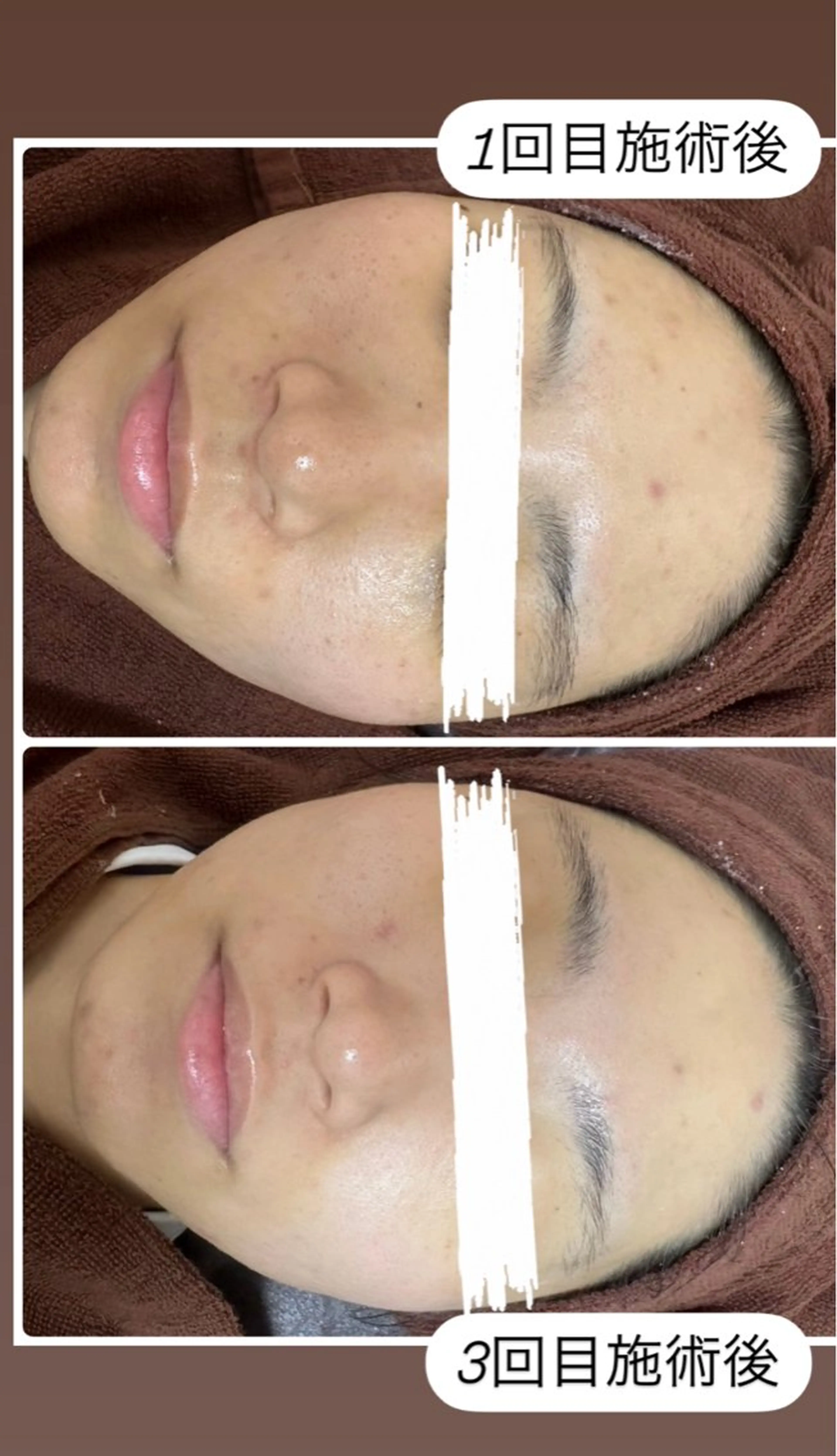 エステ 桐山 まどかのエステ・リラクイメージ