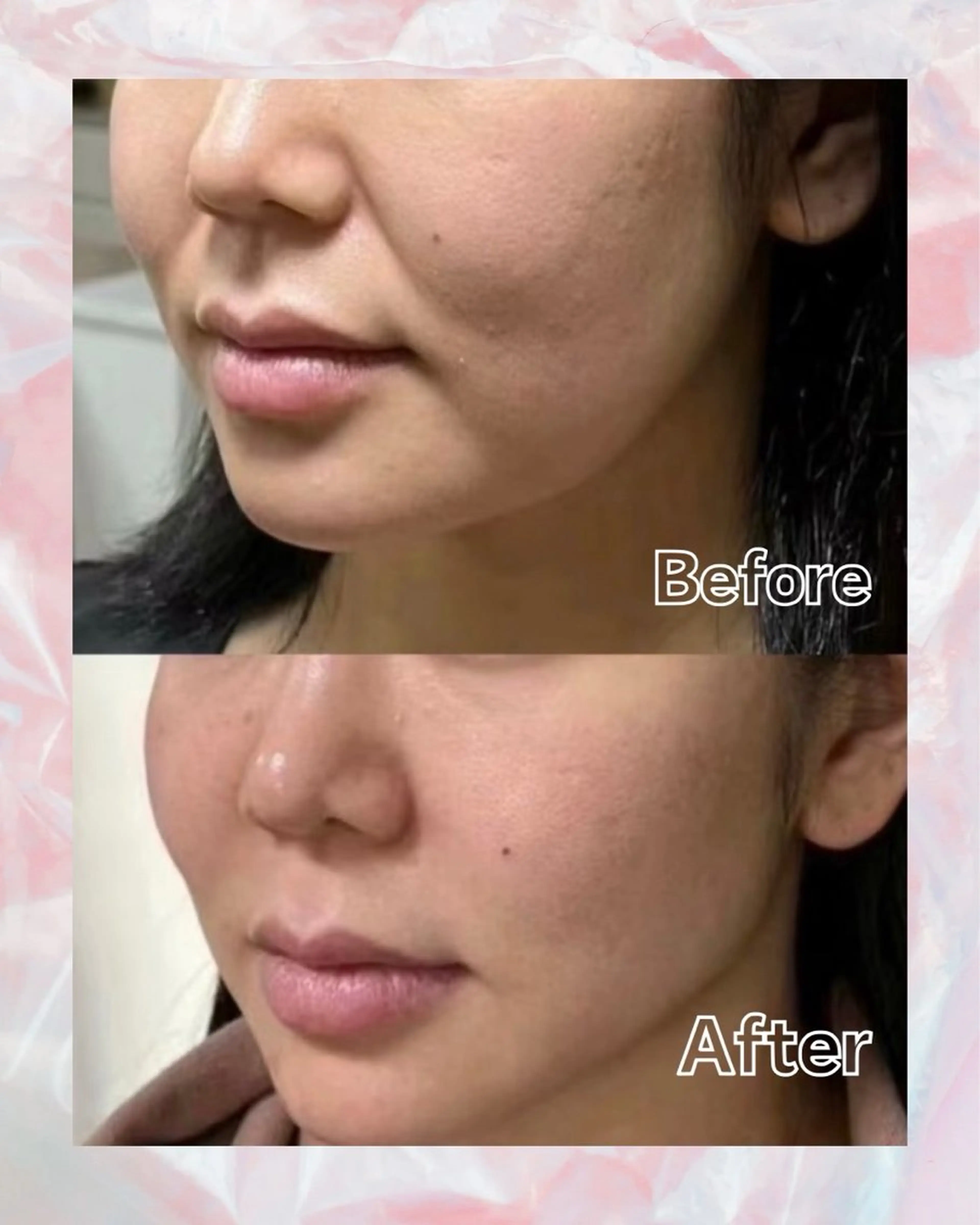 ショート エステ aliaハイフ&水光ジェットサロン所属・aliaハーブ水光店 エステティシャン募集のエステ・リラクイメージ