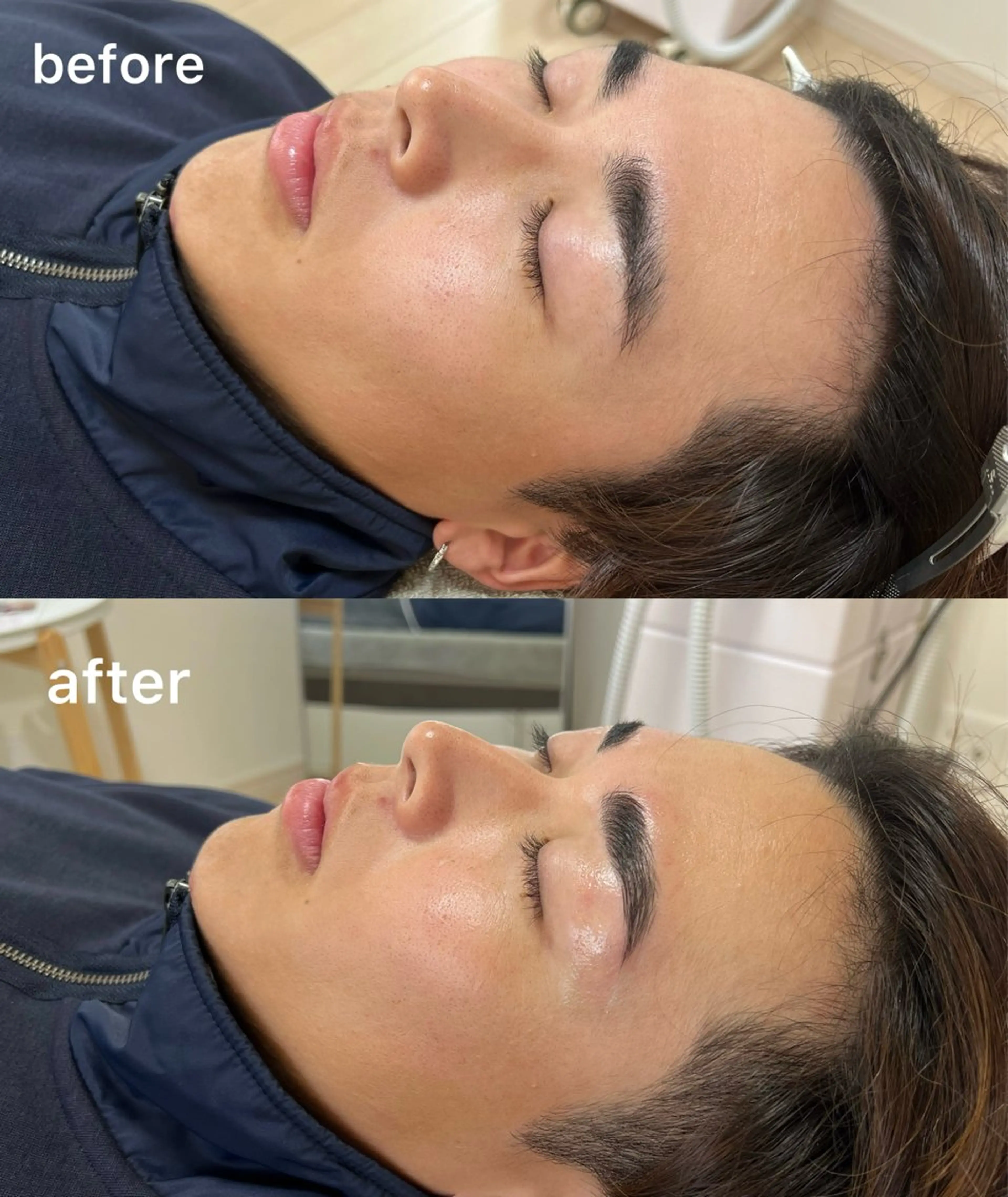 アイブロウ ハリウッドブロウリフト Akala miのエステ・リラクイメージ