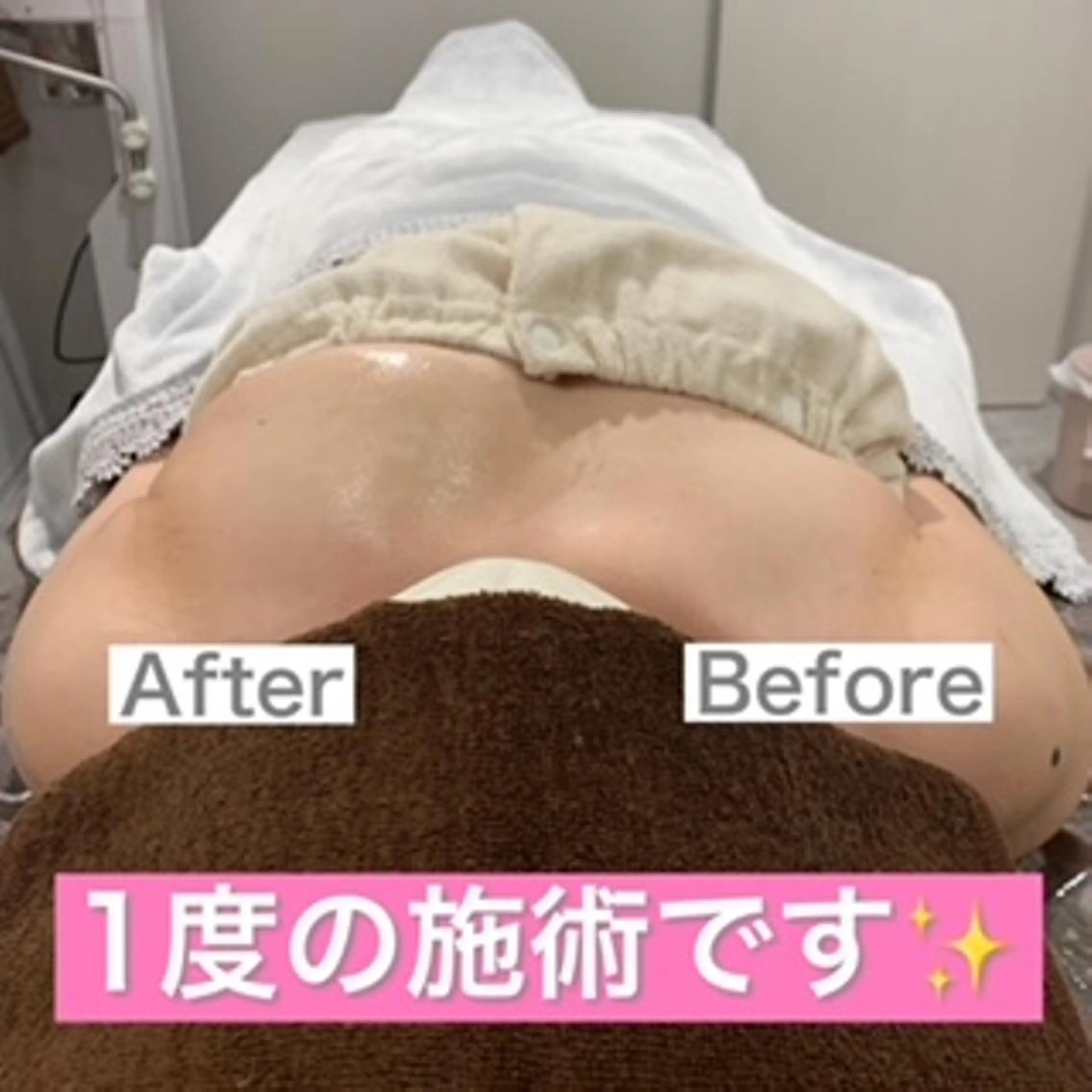 【人気NO.1】長期的なケアを検討されてる方にお得なお試し価格♥バストケア60分コース トライアルの写真