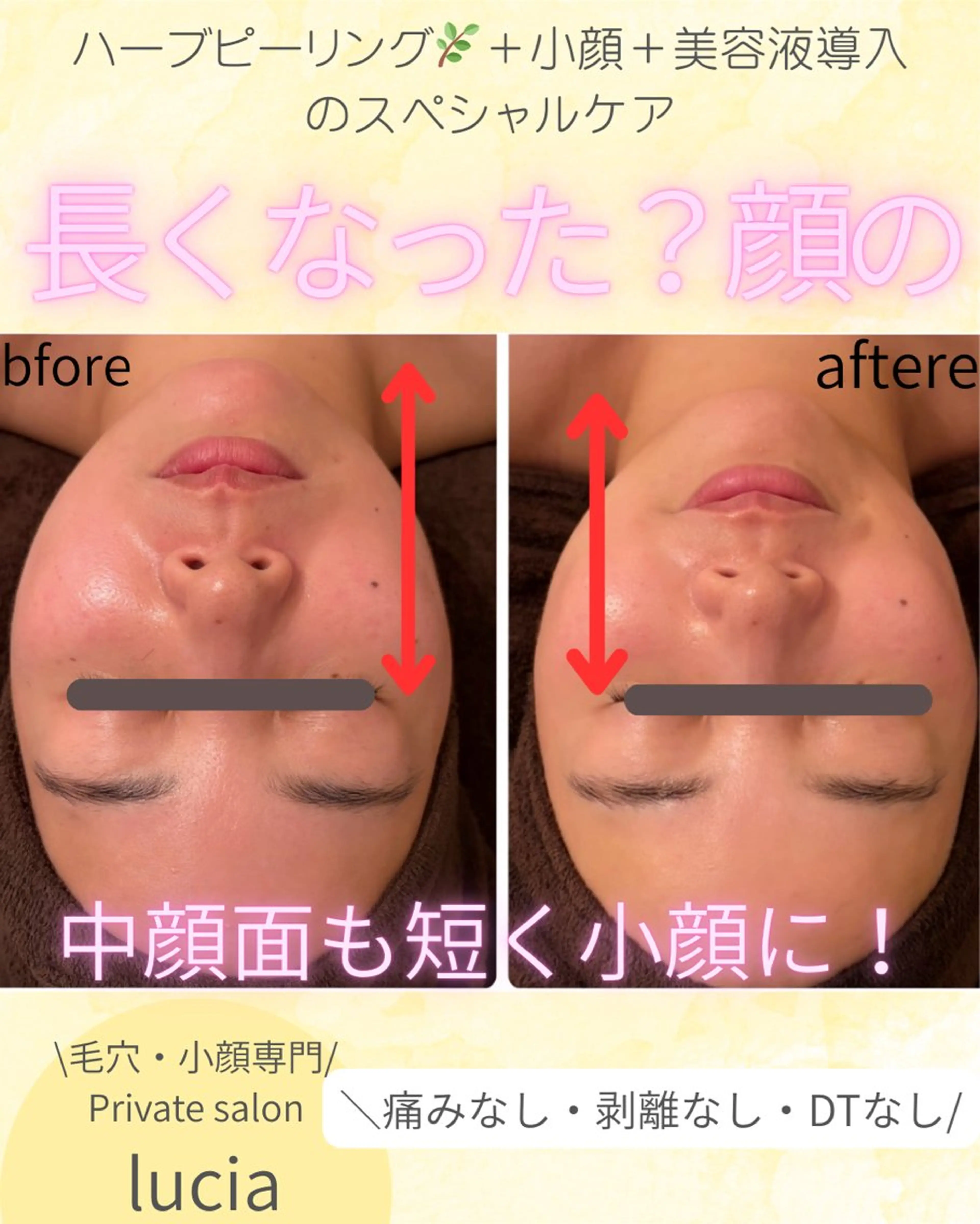 lucia  豊明 肌管理のエステ・リラクイメージ