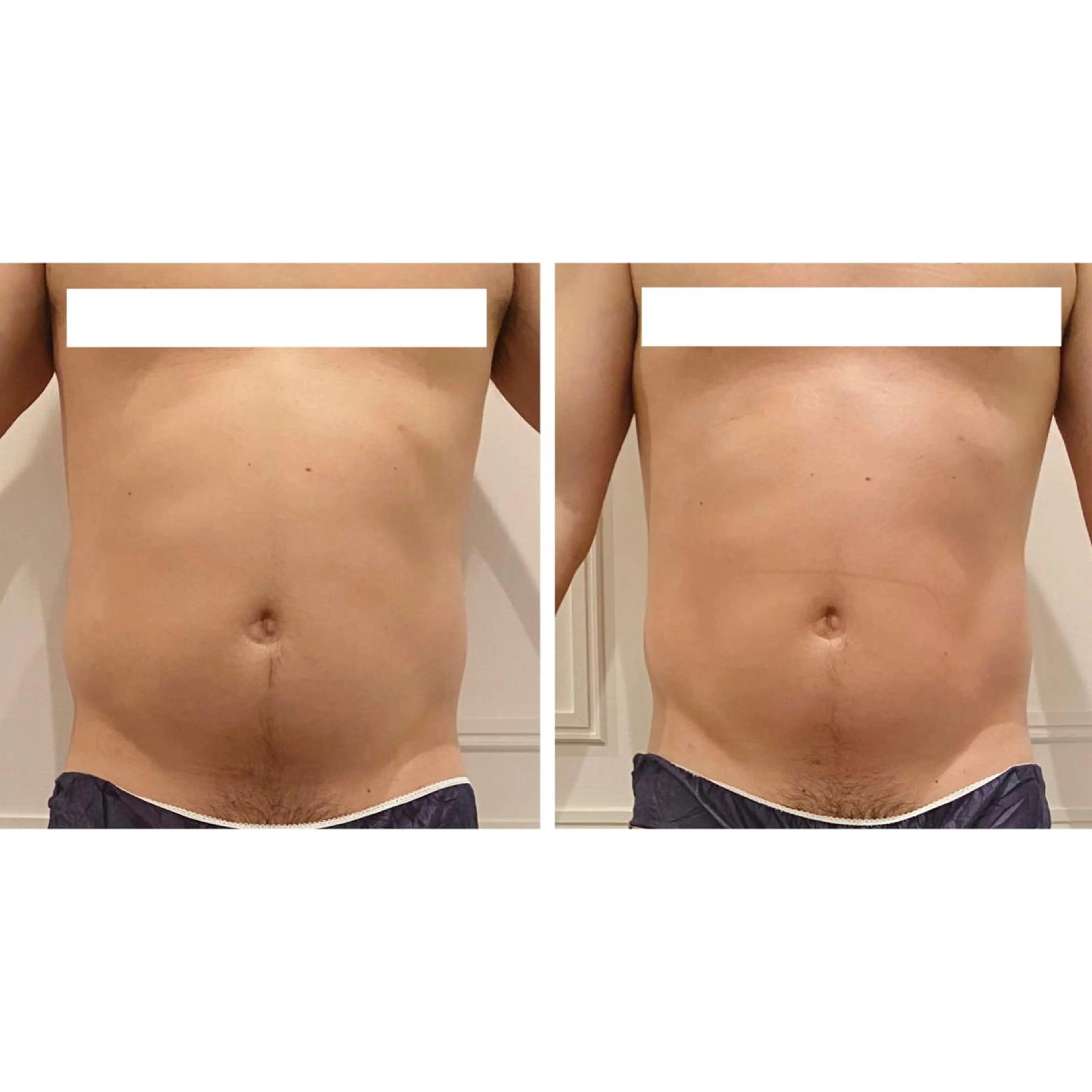 小顔EX心斎橋 REVIハーブのエステ・リラクイメージ