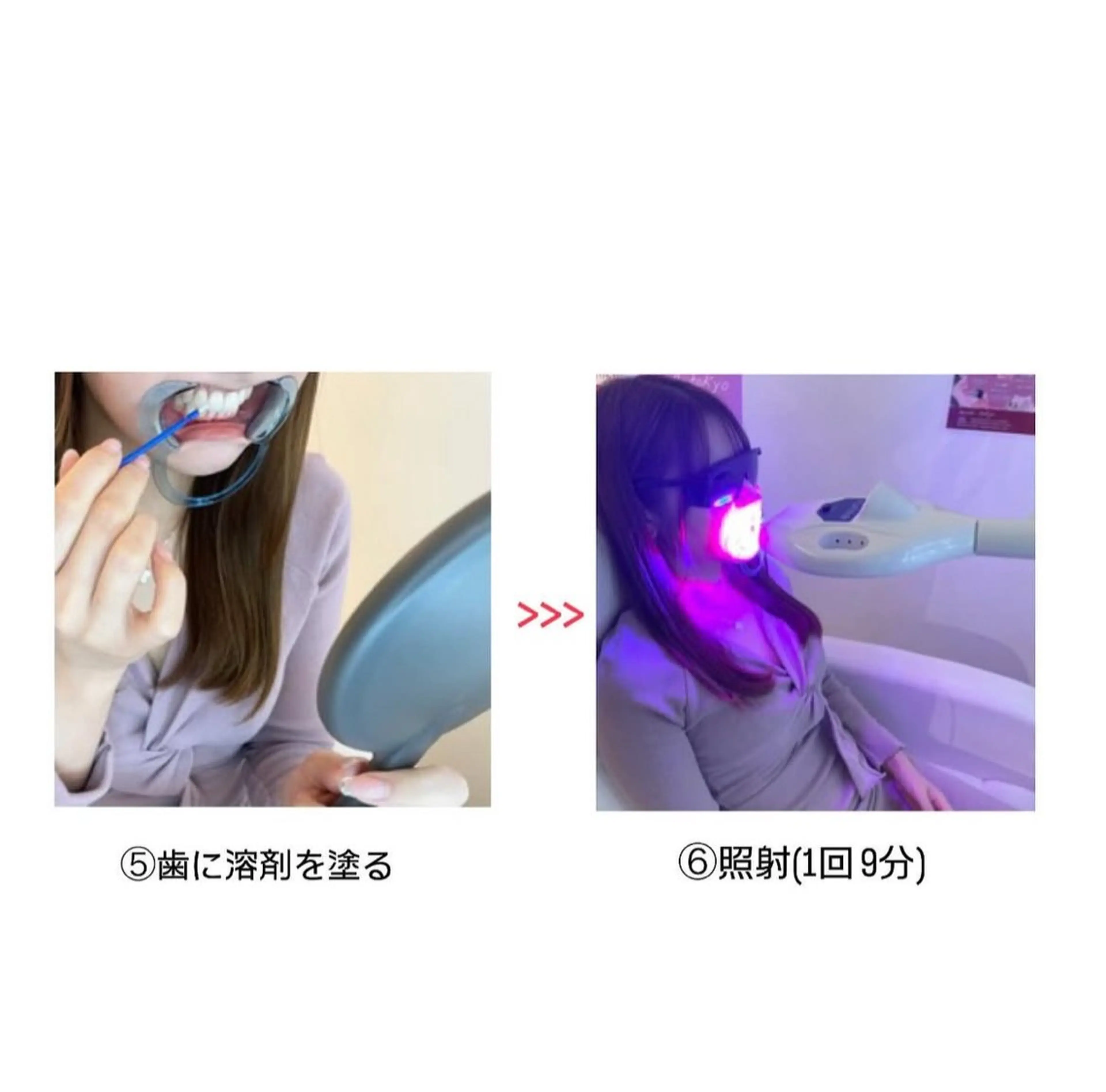 セルフホワイトニング エクシア小山店のその他イメージ